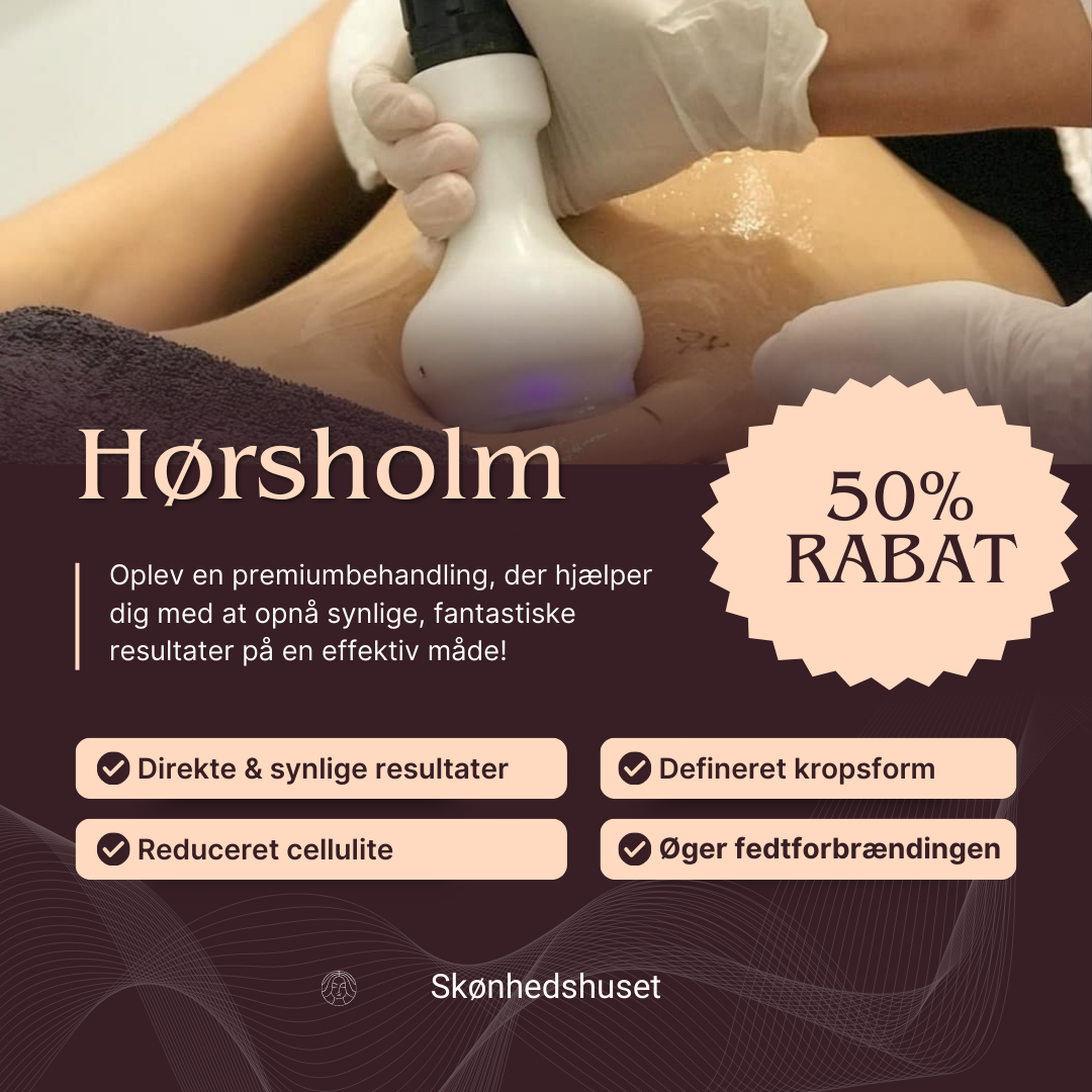 Skønhedshuset i Hørsholm Facebook ad: Cryo 21 kun kr. 750! (Normalpris kr. 1500)