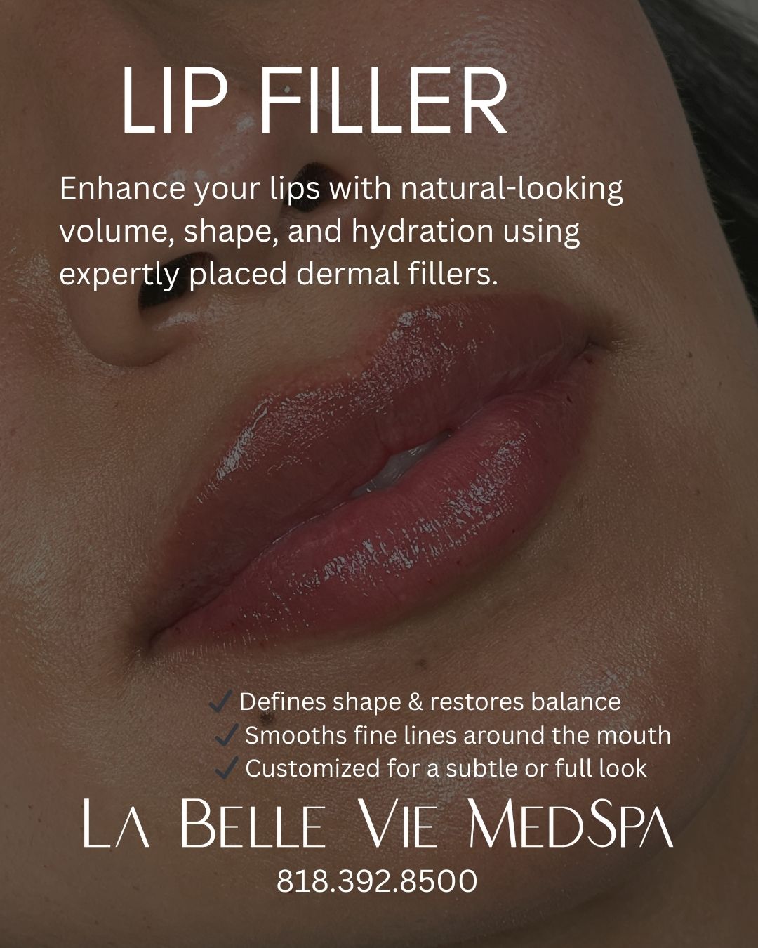 Labelleviemedspa Facebook ad