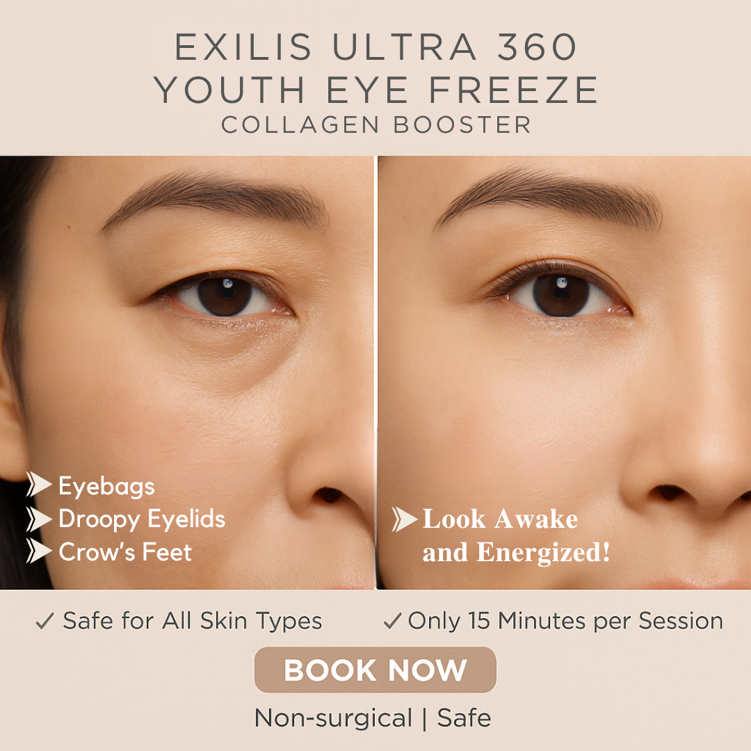 Bellezza Aesthetics Facebook ad
