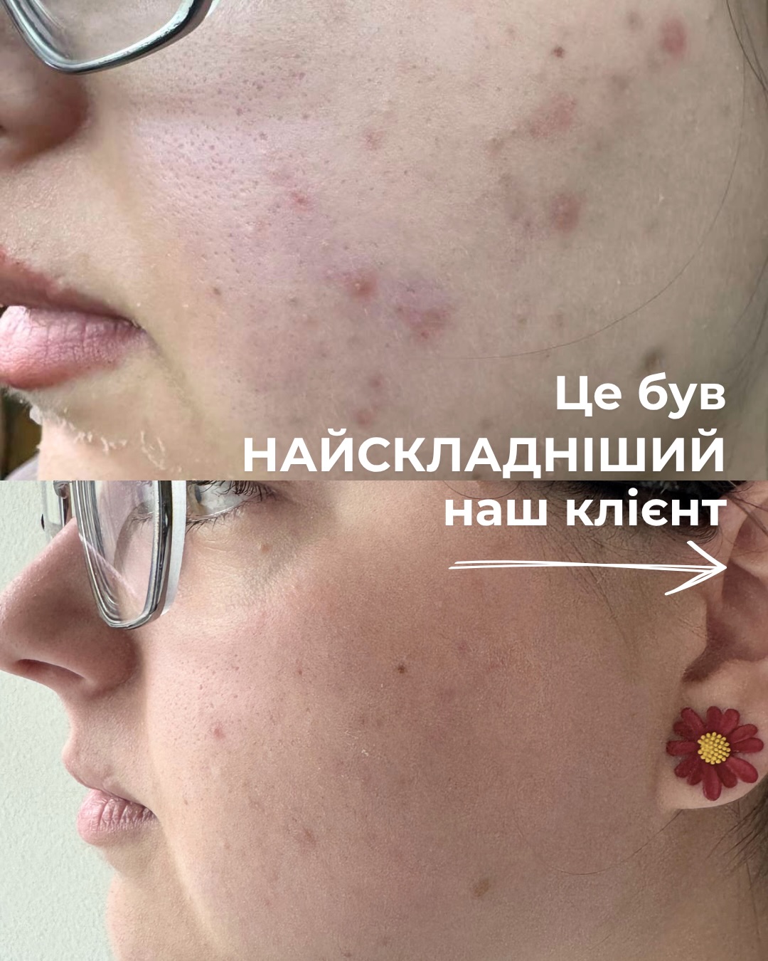 PH_Serum_Bar Facebook ad: Якщо догляд не спрацював одразу, це не привід…