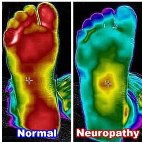 Bystrom Family Chiropractic Facebook ad