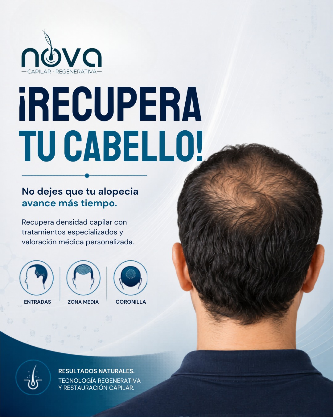NOVA Capilar Regenerativa Facebook ad: ¿Notas signos de alopecia o menos densidad capilar?