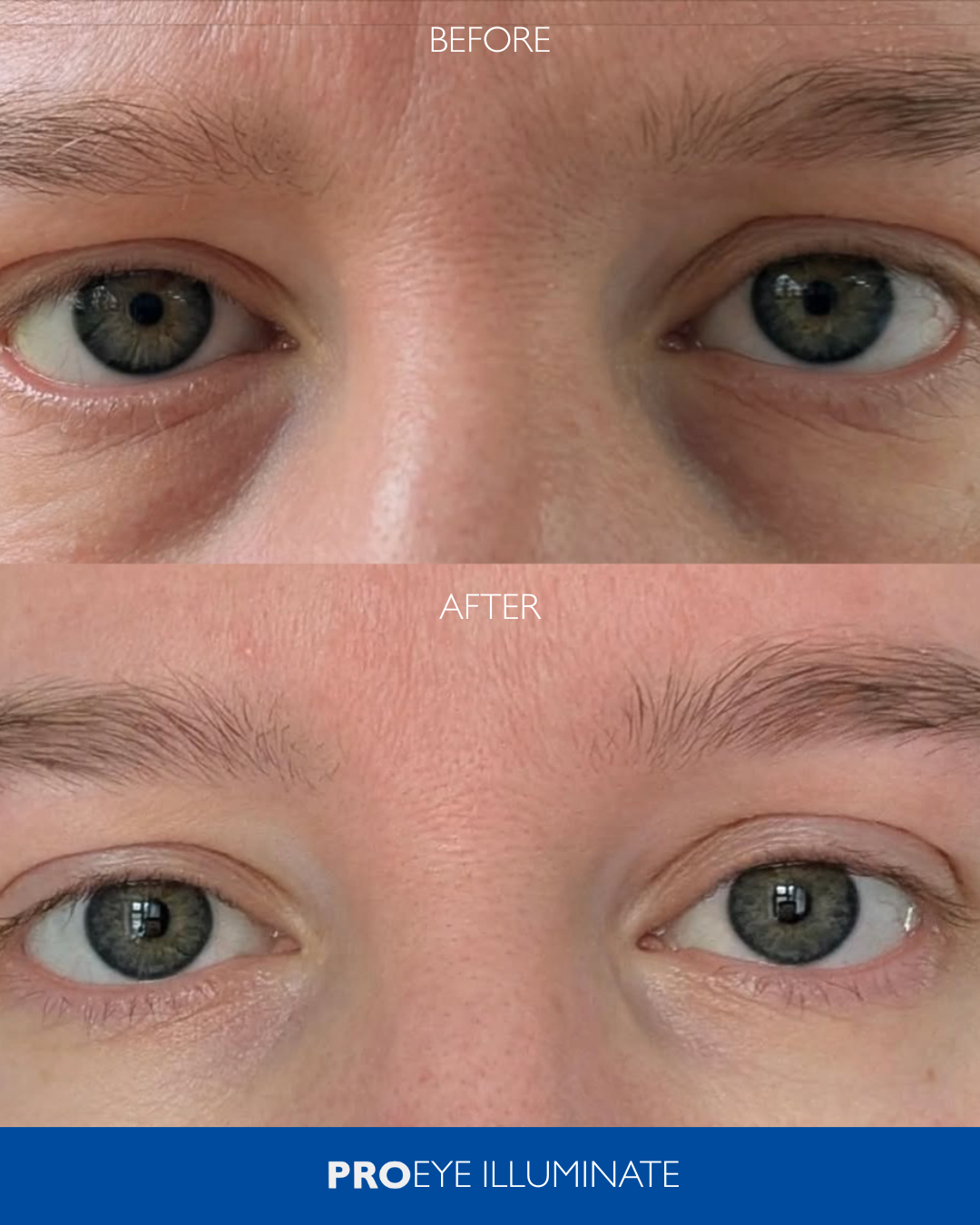 Derma Direct Facebook ad