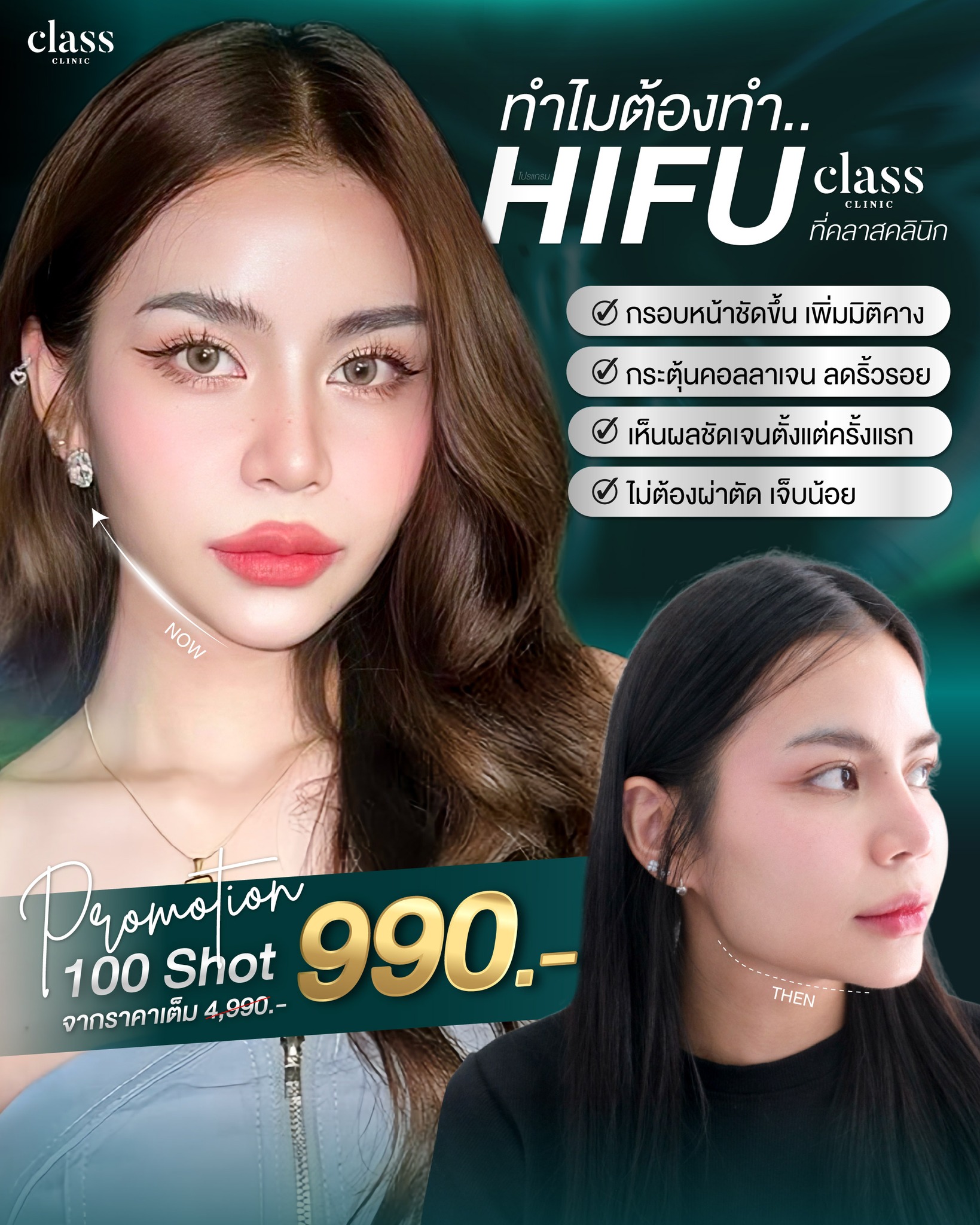 Class Clinic mahasarakham - คลาสคลินิก มหาสารคาม Facebook ad: ทำไมต้องทำ 𝗛𝗶𝗳𝘂 ที่คลาสคลินิก