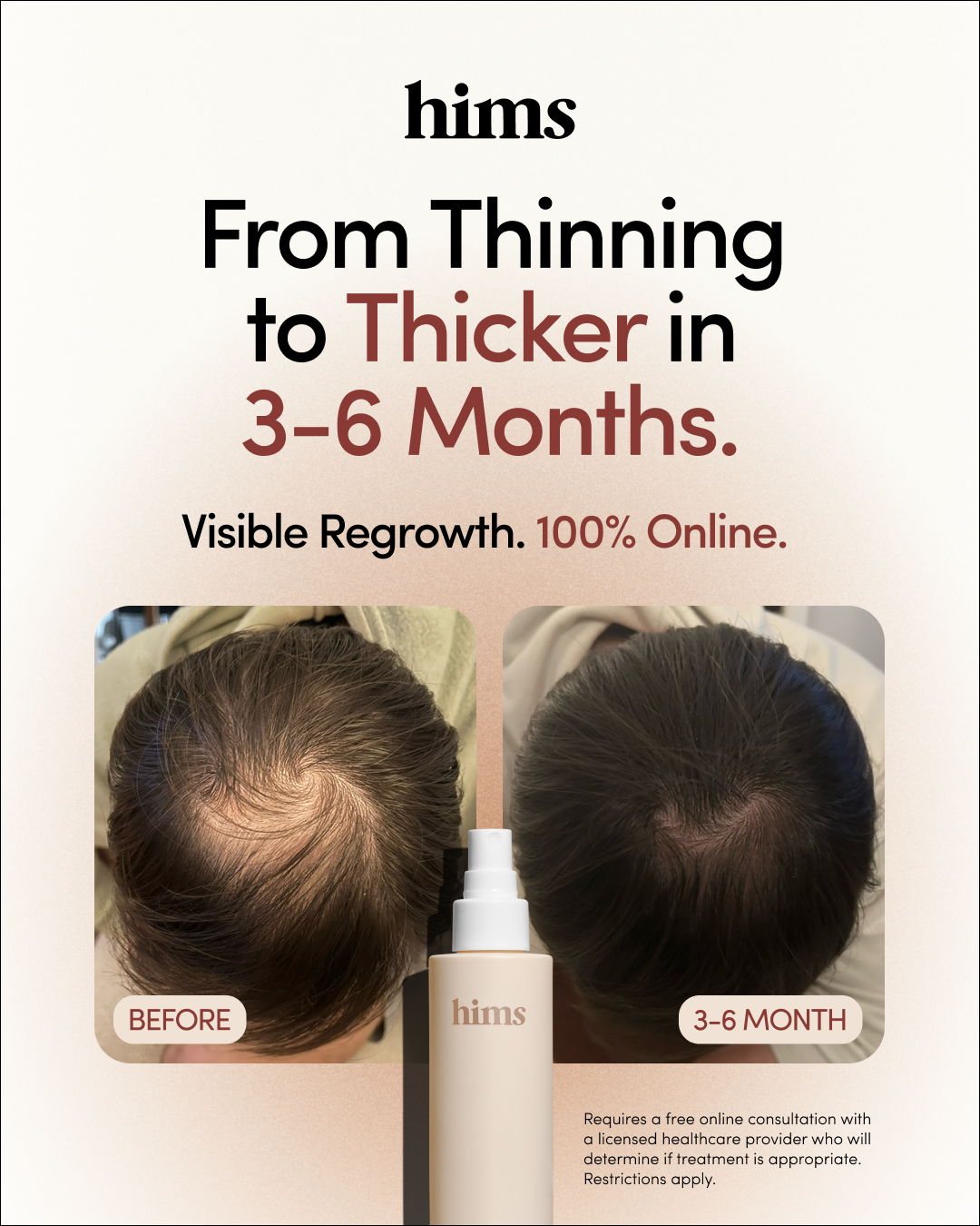 hims Facebook ad