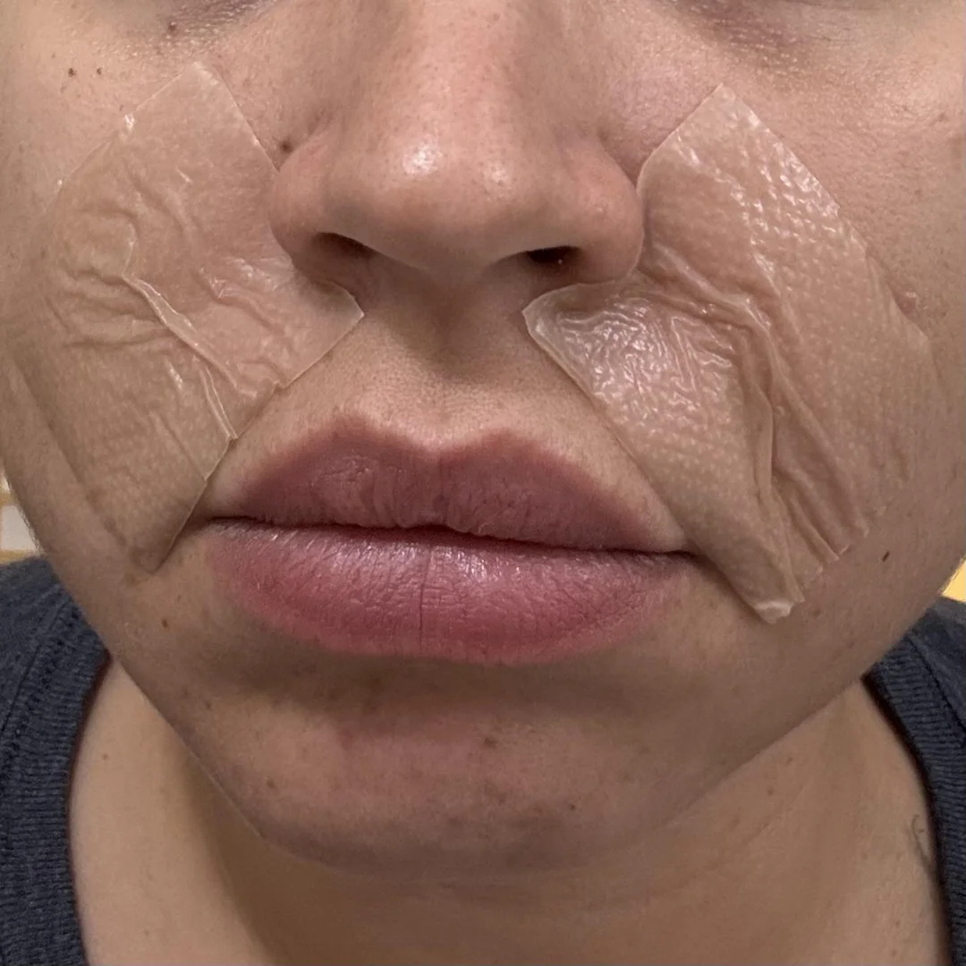 Emma’s Glow Diary Facebook ad: Read If You Can't Get Rid of Face Lines