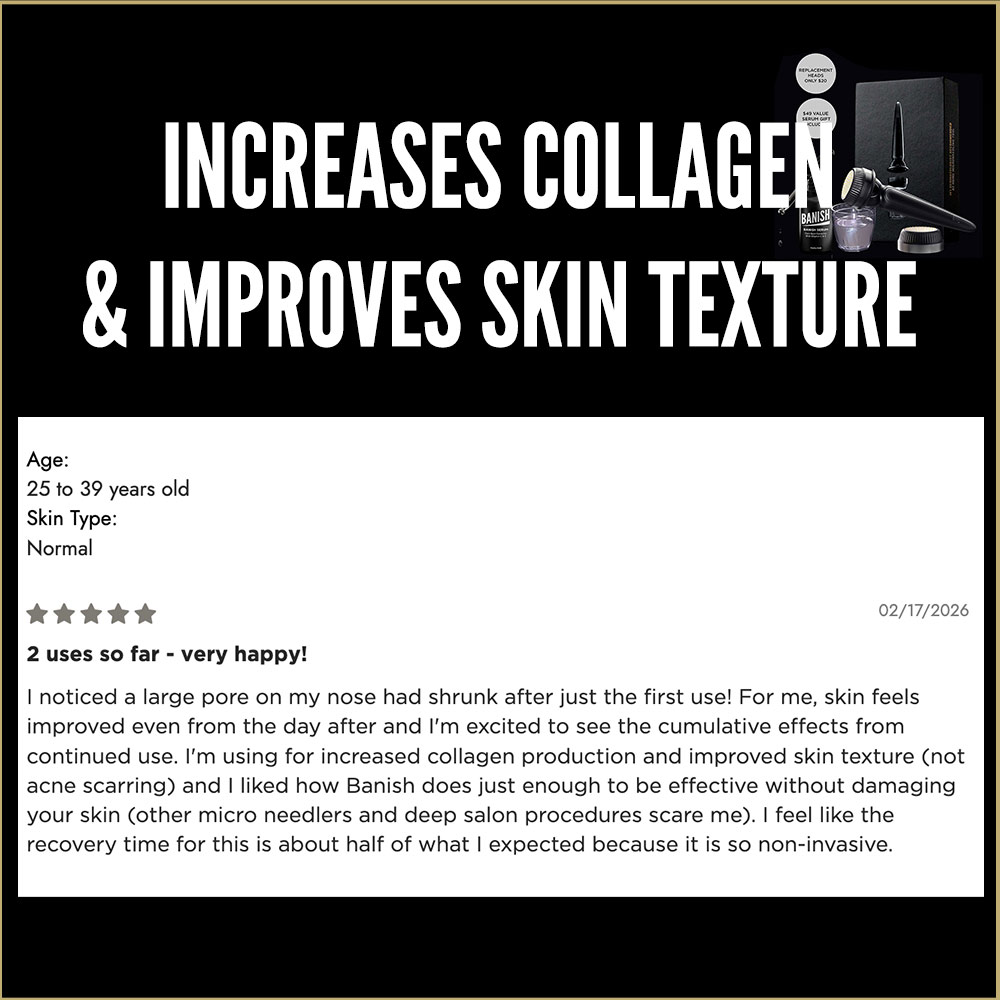 Banish Acne Scars Facebook ad