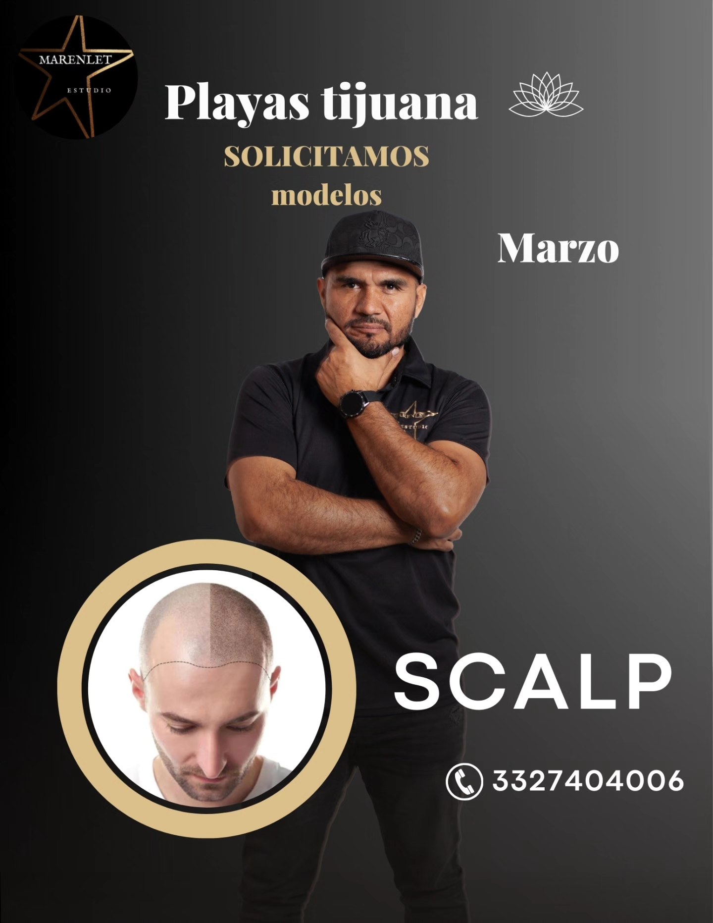 Estudio Marenlet Facebook ad: ¡BUSCAMOS MODELO DE MICROPIGMENTACIÓN CAPILAR!