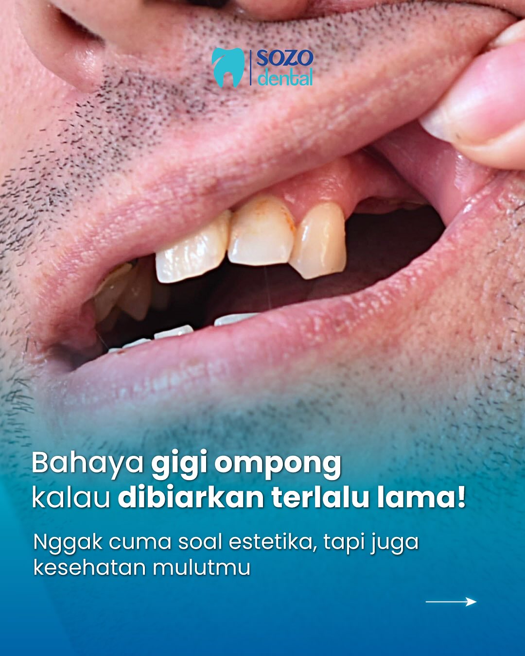 Sozo Dental Clinic Facebook ad