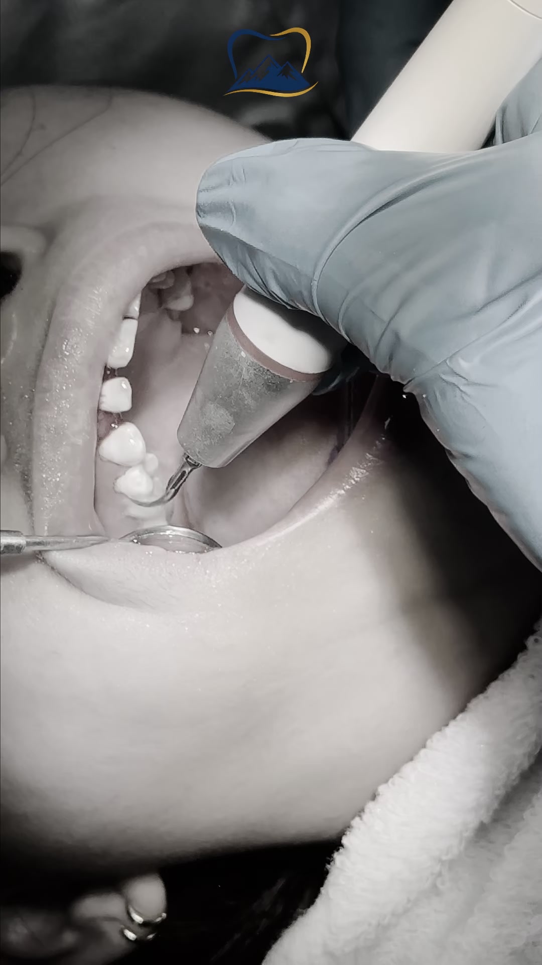 Zion Dental Clinic - Tanza Facebook ad: Dumudugo Gums During Cleaning?
