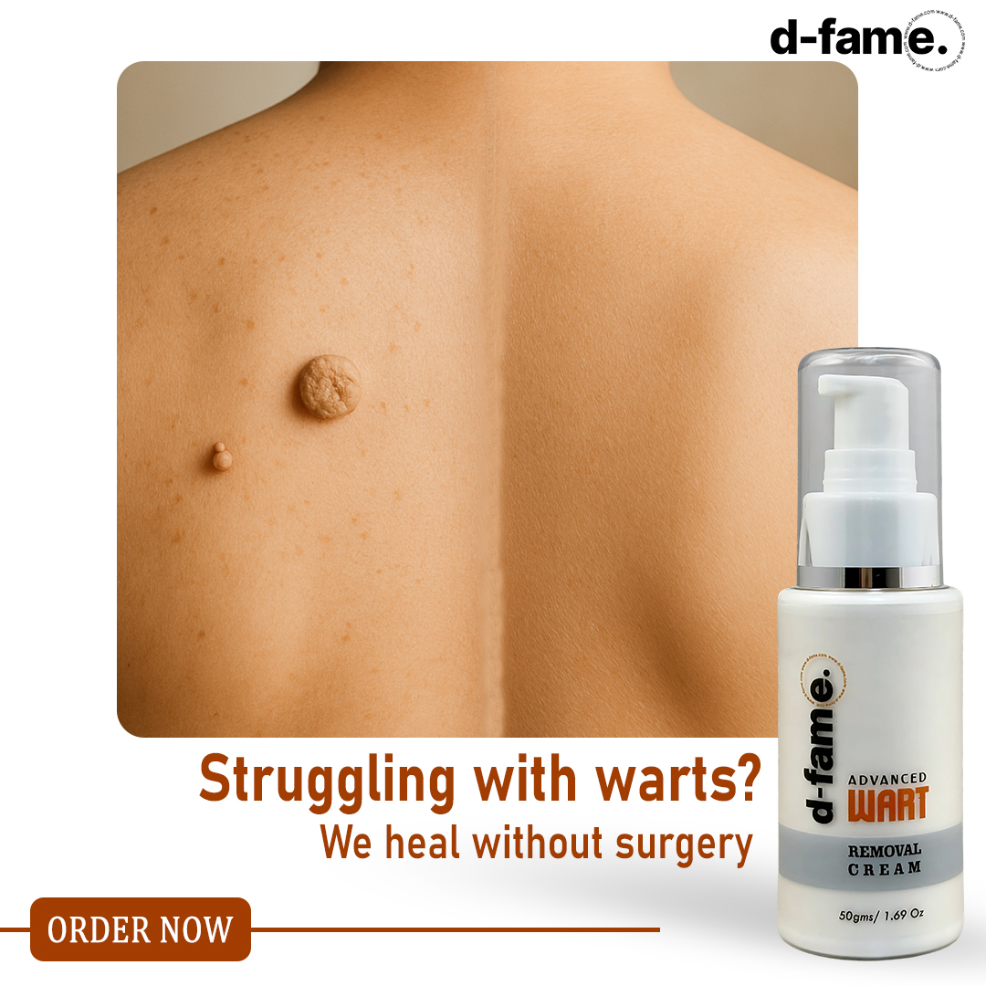 D-Fame.com Facebook ad: Painless Wart Removal at home!