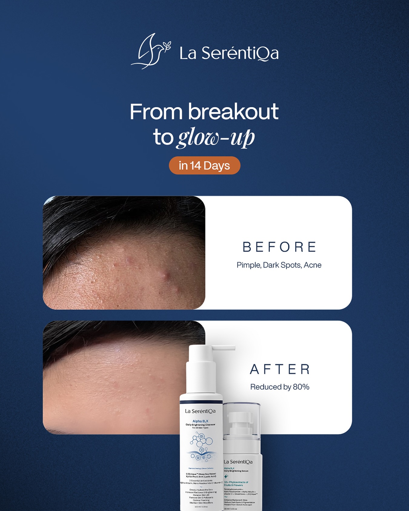 La Serentiqa Facebook ad: La SeréntiQa Acne Care Kit | Alpha B3X Daily Brightening…