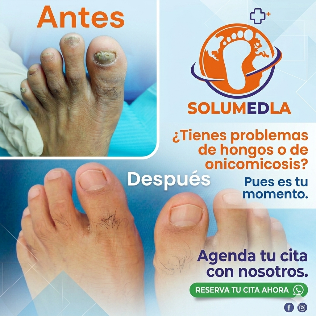 Podologia Solumedla Facebook ad: Tratamiento Clínico Profesional para Hongos, Uñas…