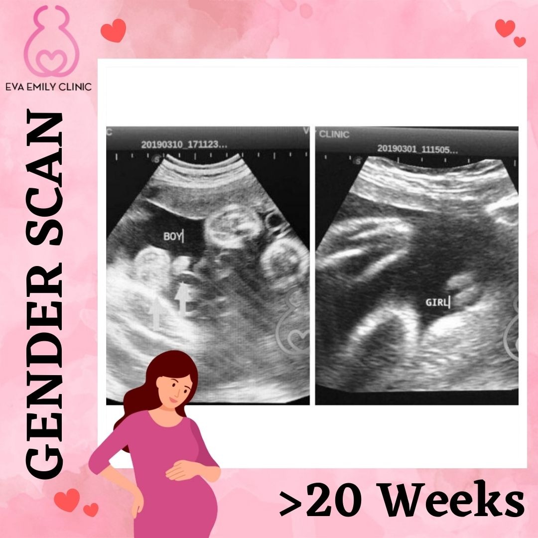 Eva Emily Clinic II Facebook ad: ๐๐๐๐๐๐๐๐๐๐ ๐๐๐ ๐๐๐๐ ๐๐๐๐๐๐ ๐๐๐๐