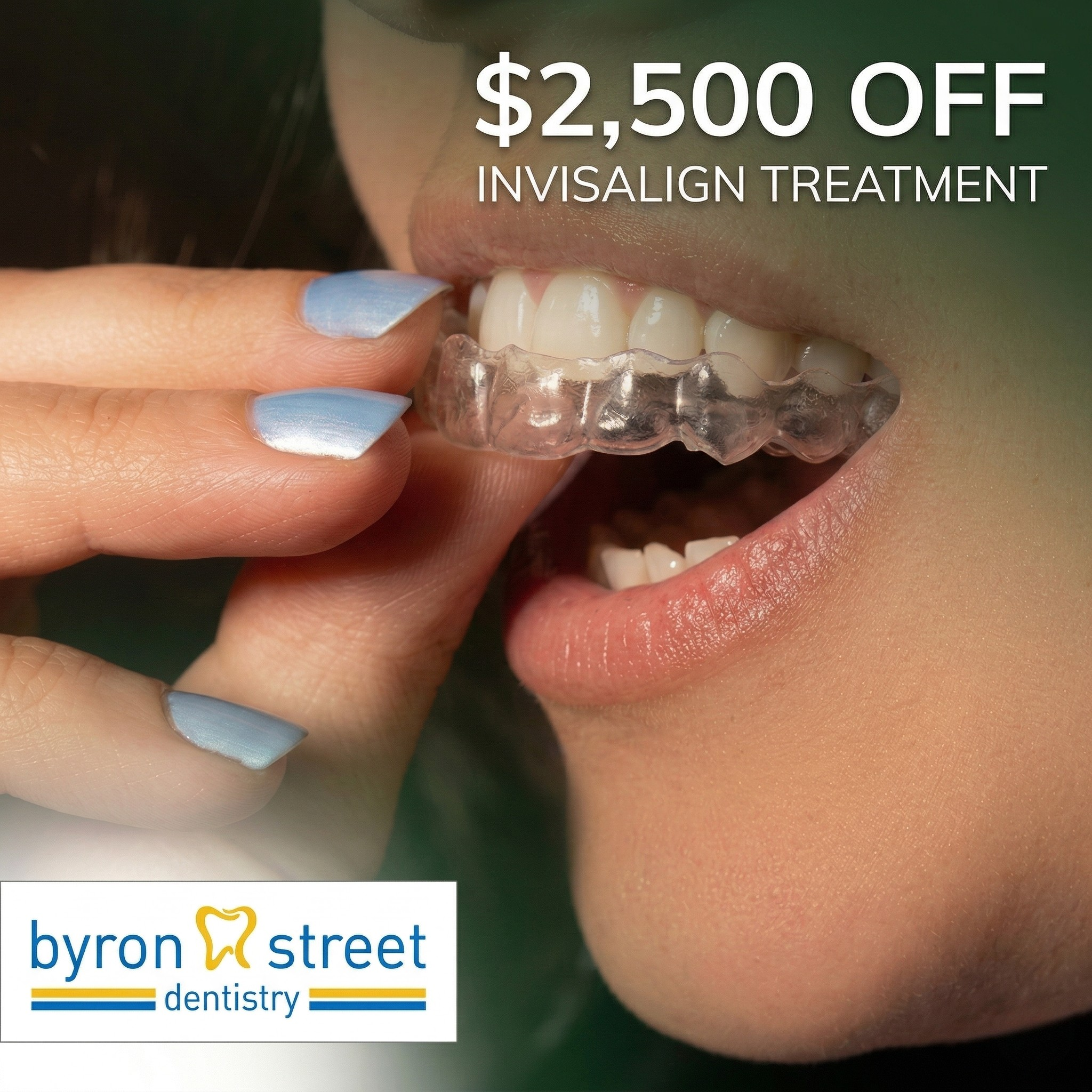 Byron Street Dentistry Facebook ad