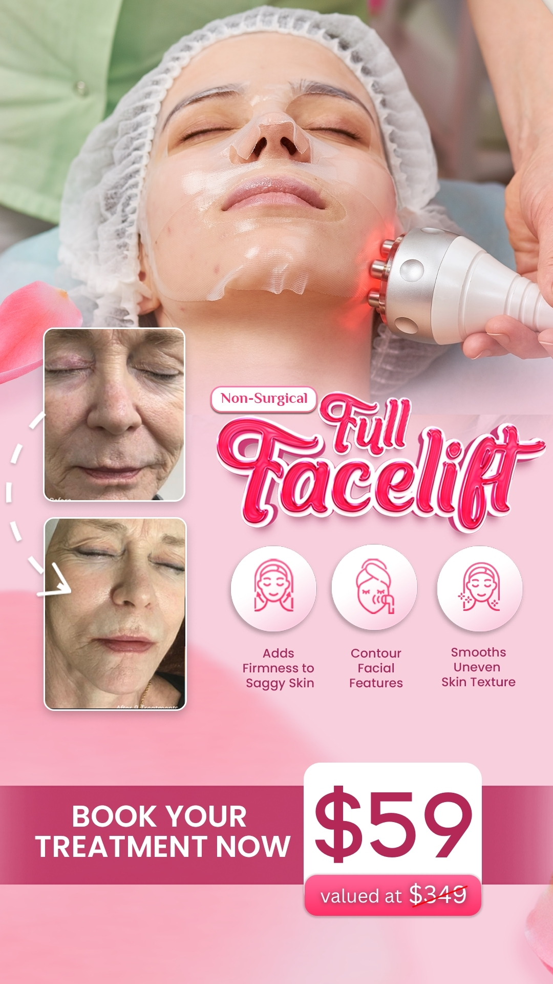 I Love Skin Treatments Facebook ad
