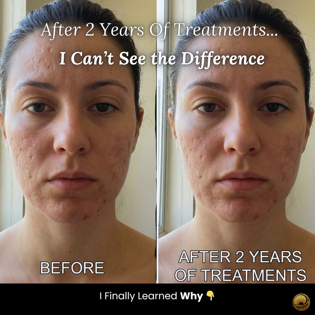 Terraura Facebook ad: Why Your Scar Treatments Keep Failing