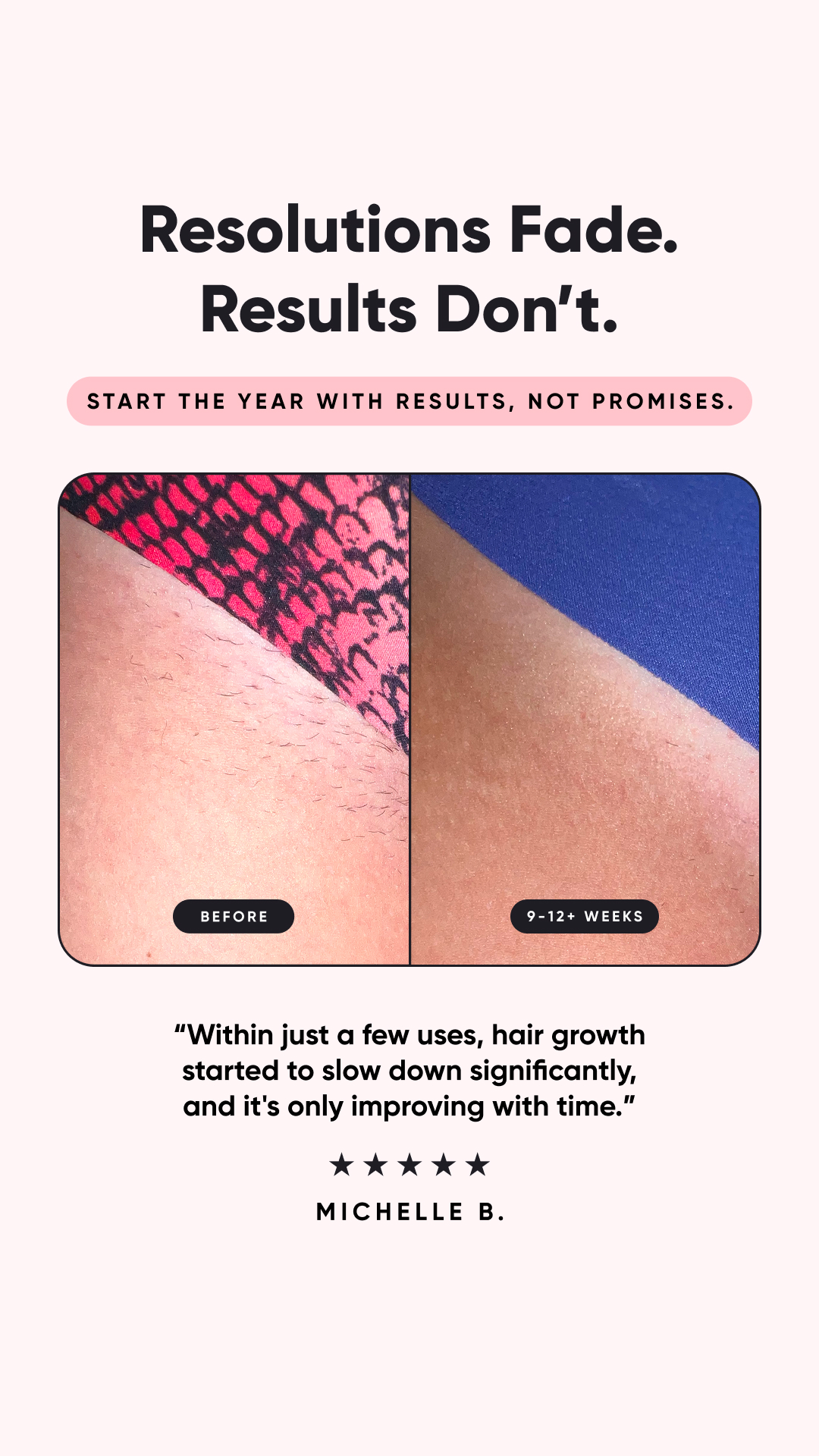 Rose Skin Co Facebook ad