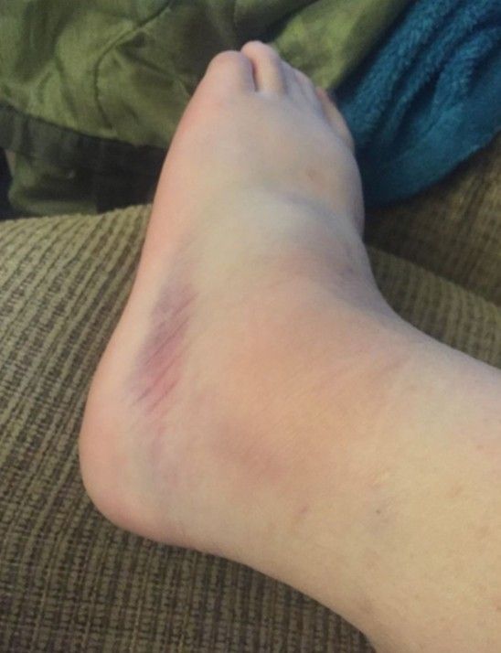 Barbara Adams Facebook ad: Managed A1C? Tingling Feet? Read This.