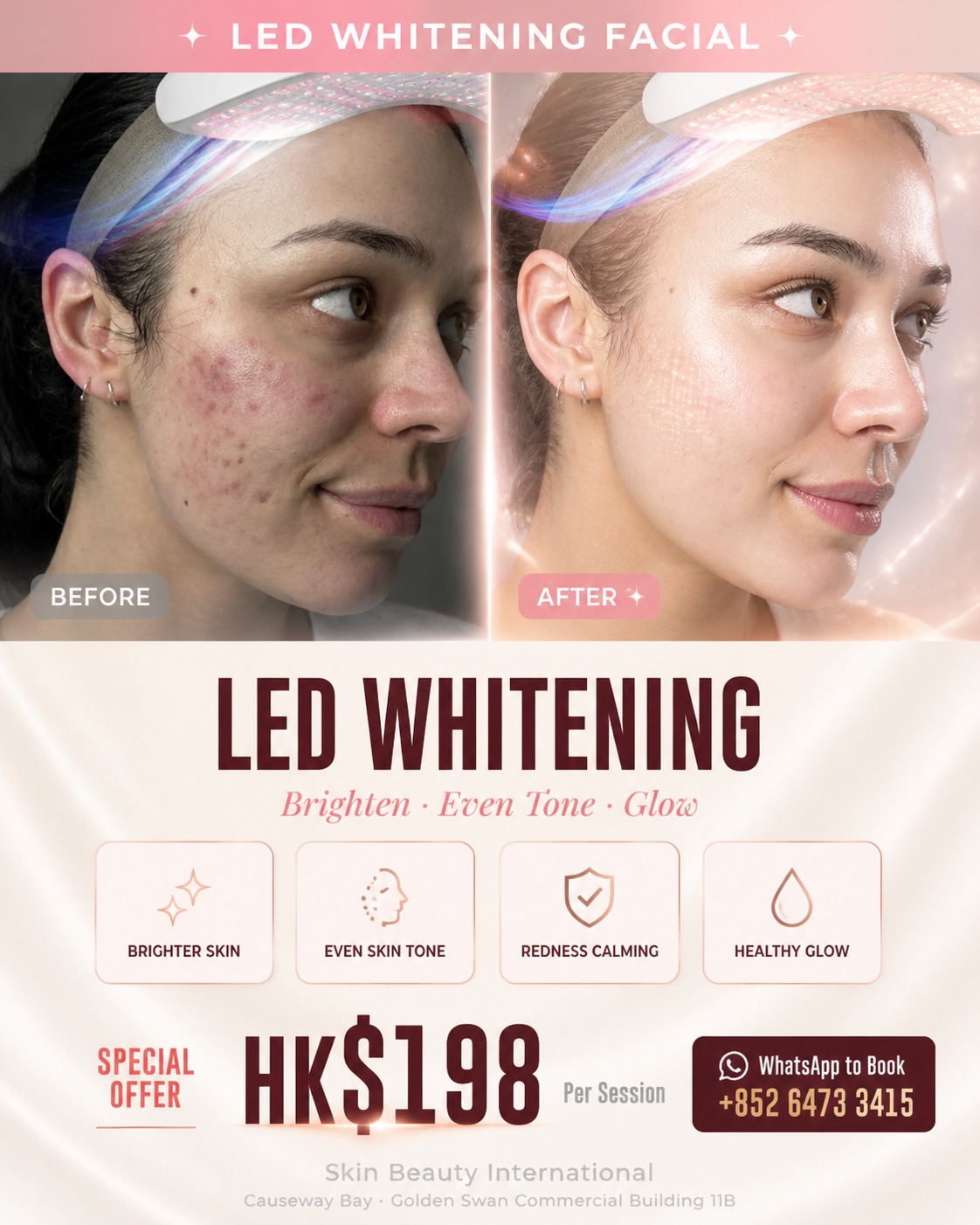 Skin Beauty International Facebook ad