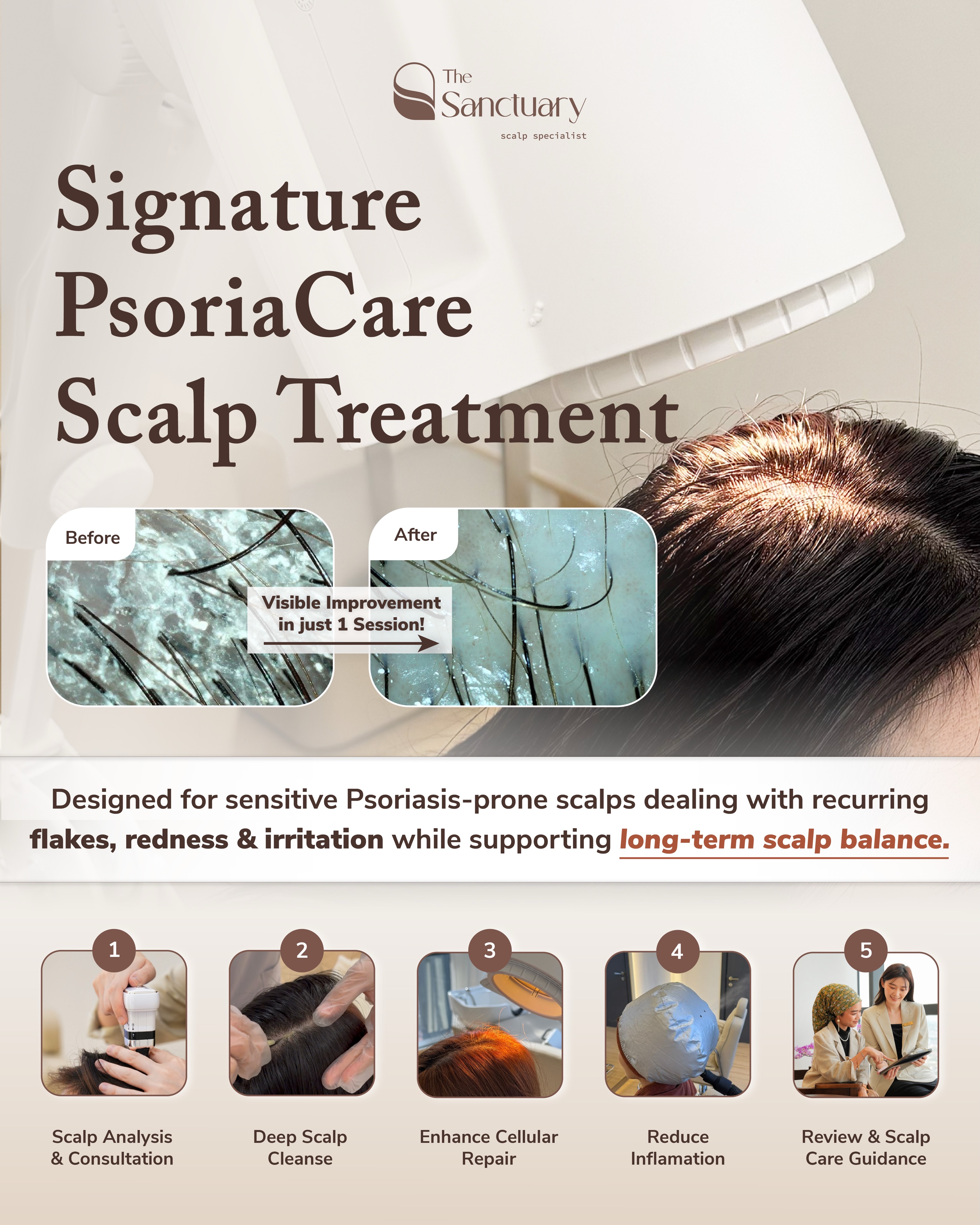 The Sanctuary Scalp Care Centre Facebook ad