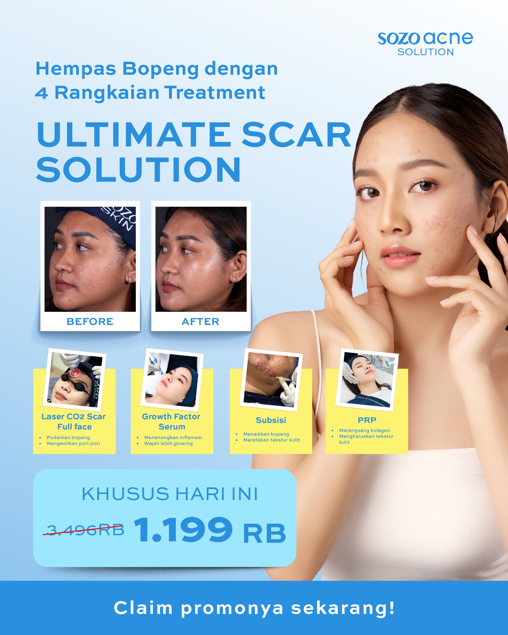 Sozo Acne Facebook ad