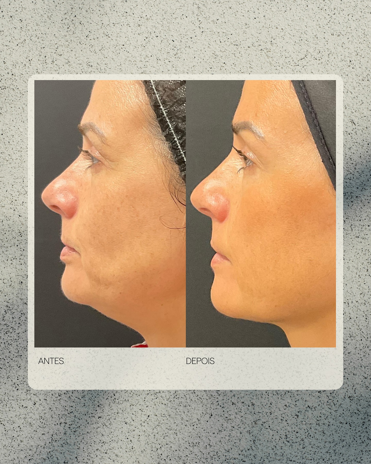 S3 Clinic Facebook ad: Resultados reais acontecem quando cuidamos do corpo como…
