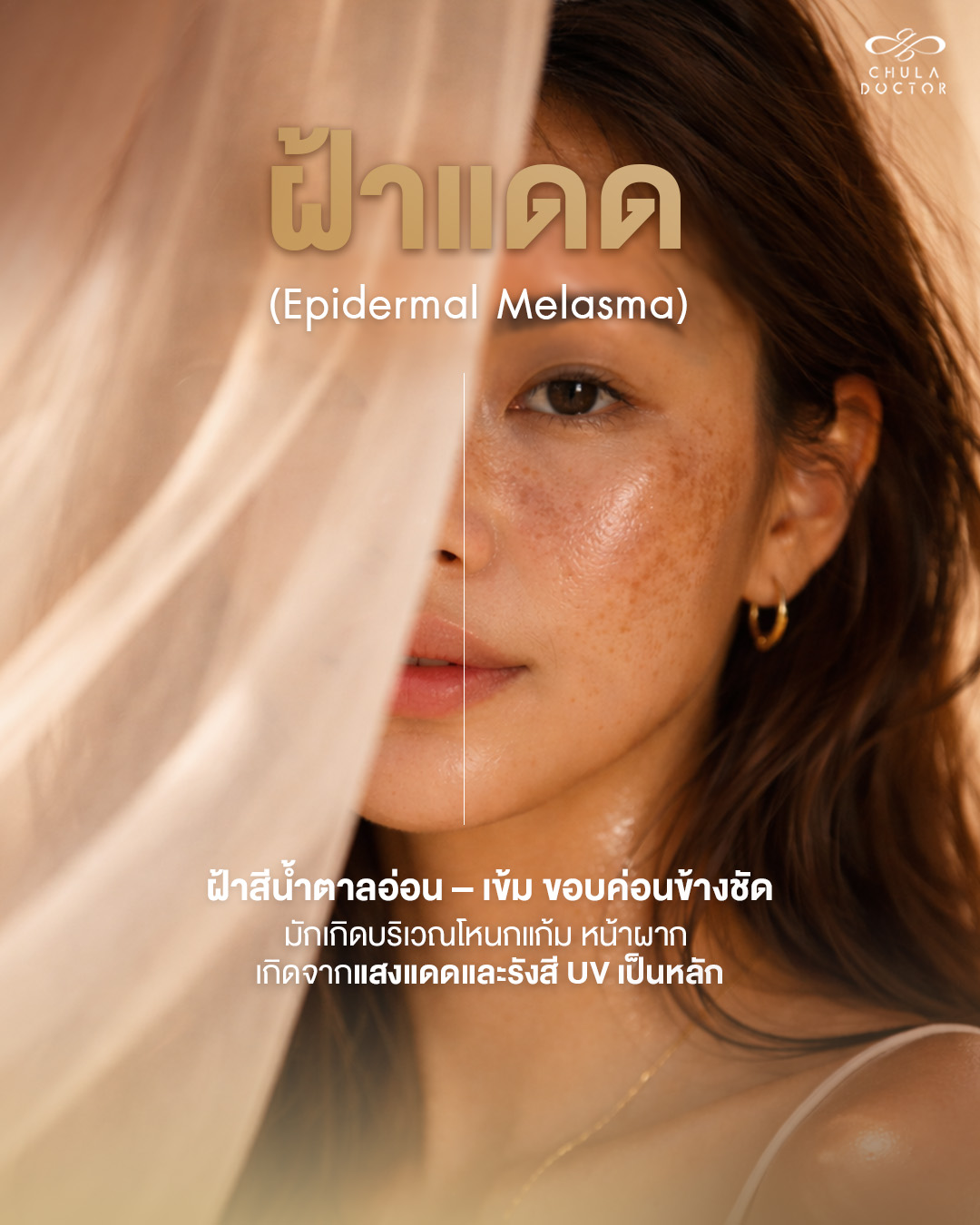 รักษาฝ้าไม่ใช้ความร้อน Chuladoctor Wellness Facebook ad