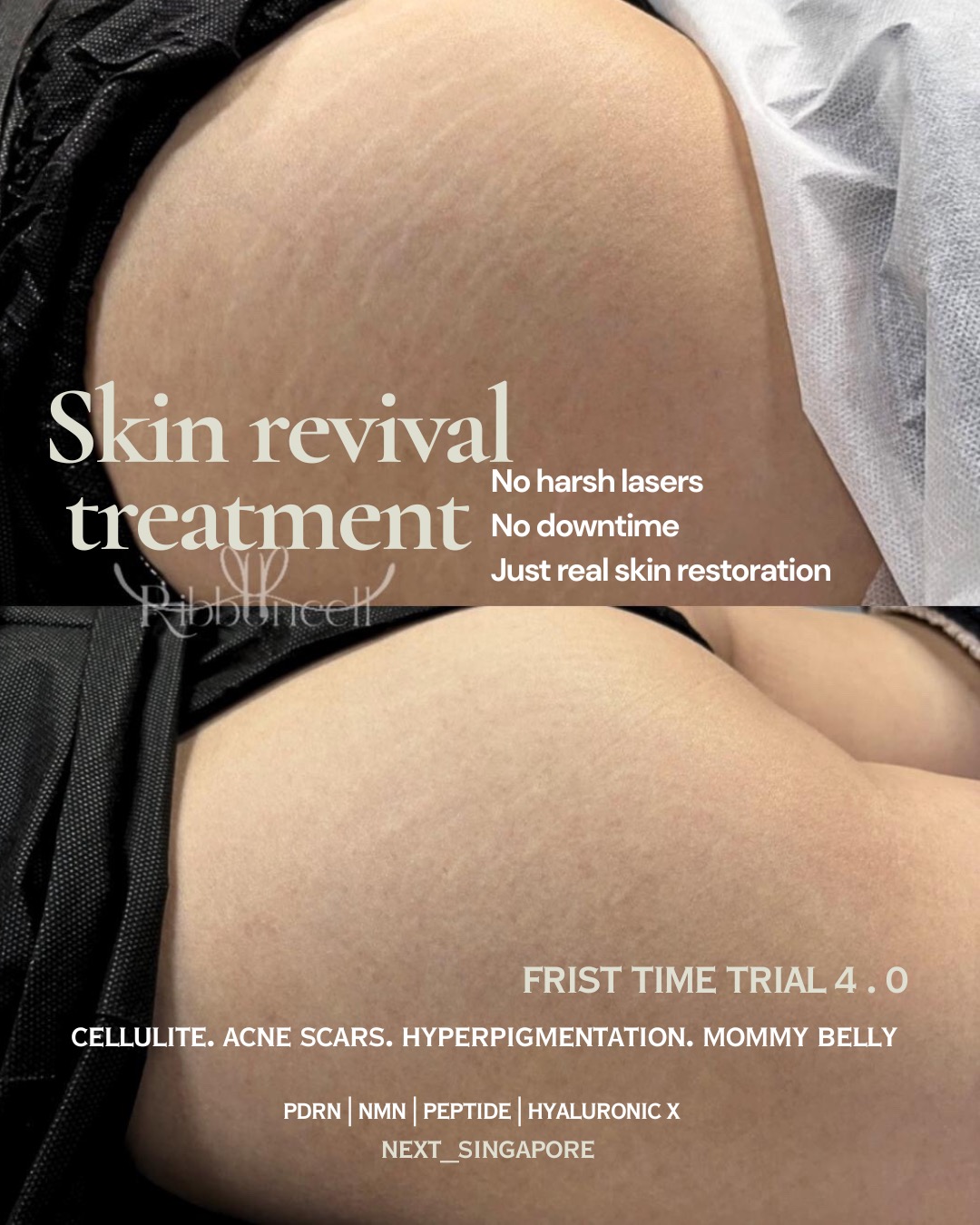 Next 1st Korea Scalp Micro-Pigmentation Facebook ad: FIRST TIMER ONLY, SKIN REVIVAL LAUNCH (JAKARTA)