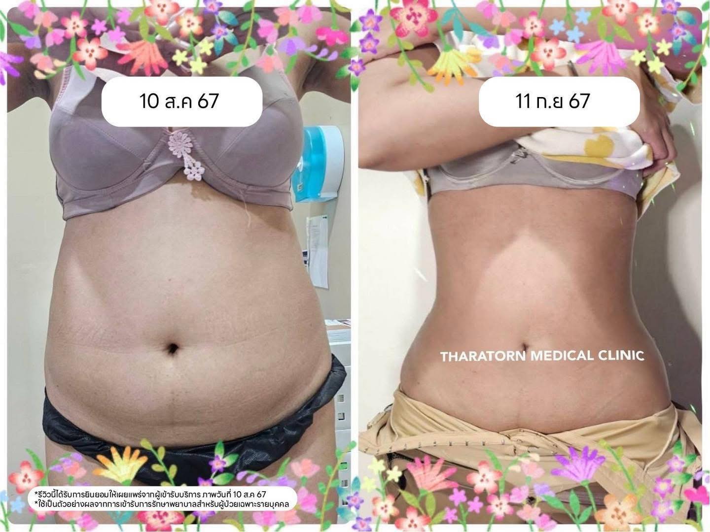 Tharatorn Medical Clinic Facebook ad