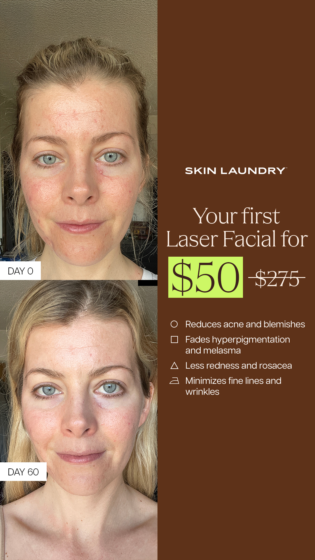 Skin Laundry Facebook ad