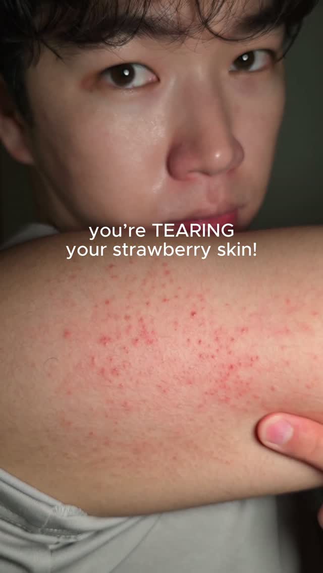 ANUA_Global Facebook ad: When it comes to getting rid of strawberry…