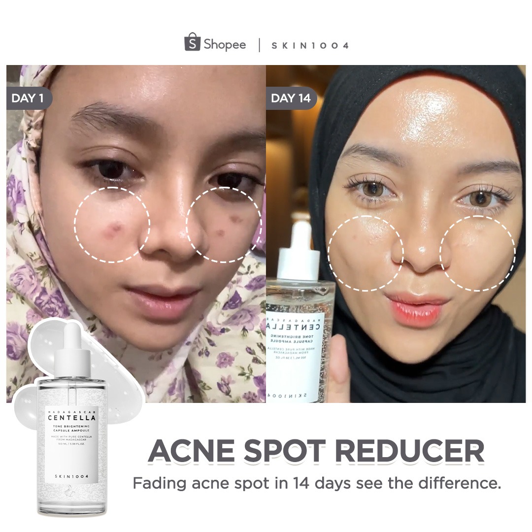 SKIN1004 Philippines Facebook ad