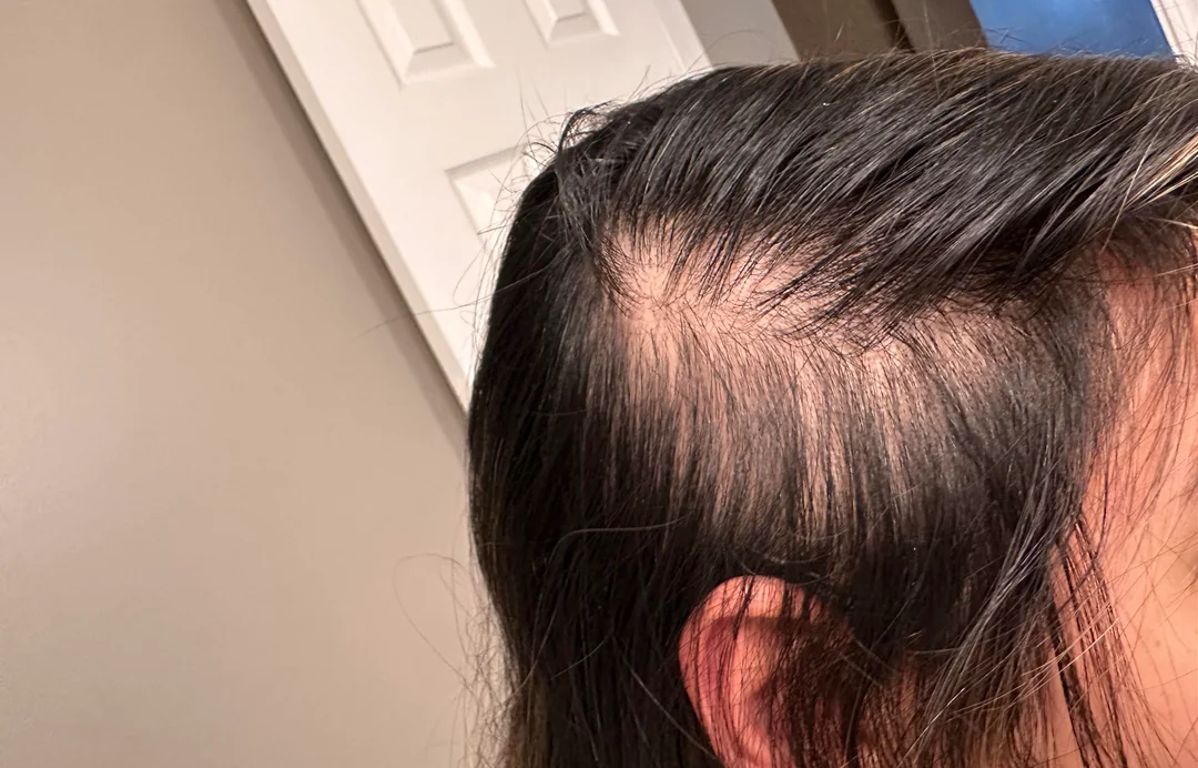 Hair Solutions Facebook ad