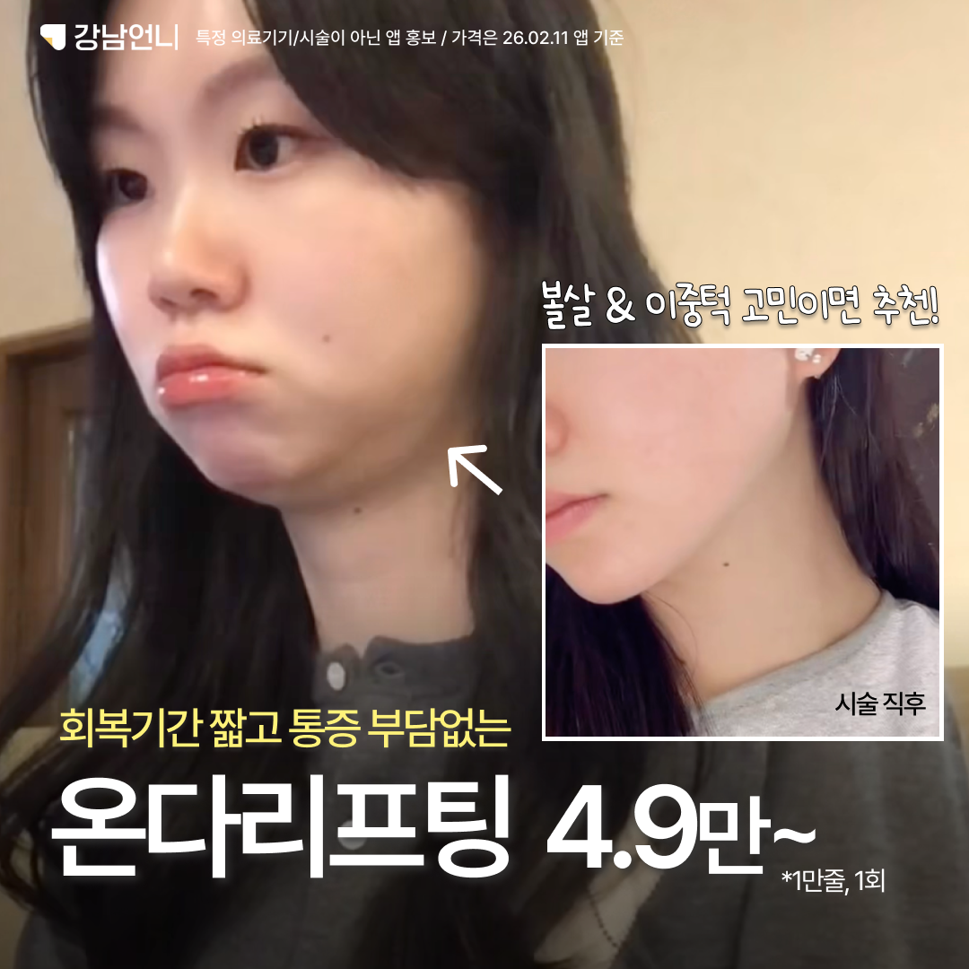 강남언니 Facebook ad
