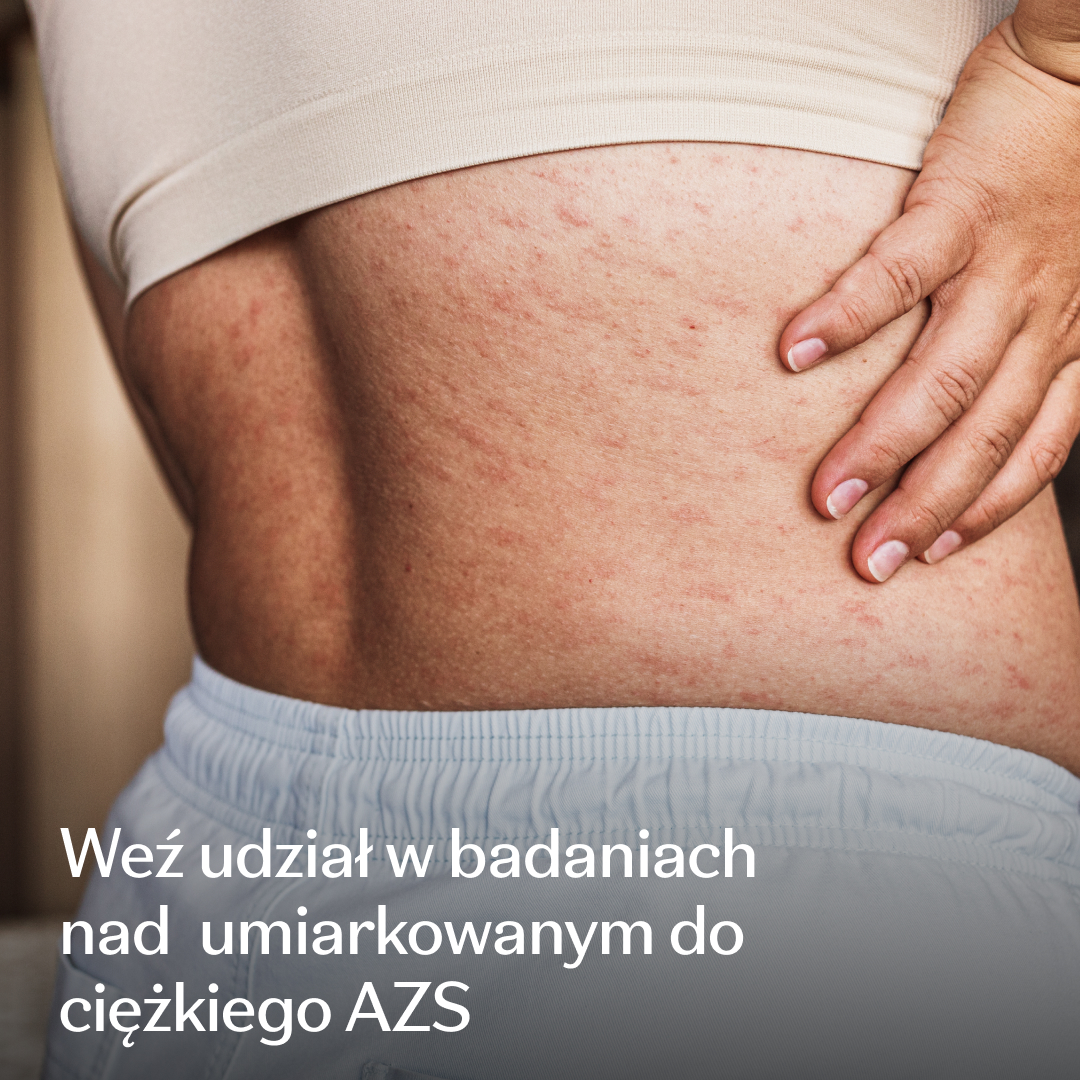 Eczema Research Study Facebook ad: Badania nad AZS