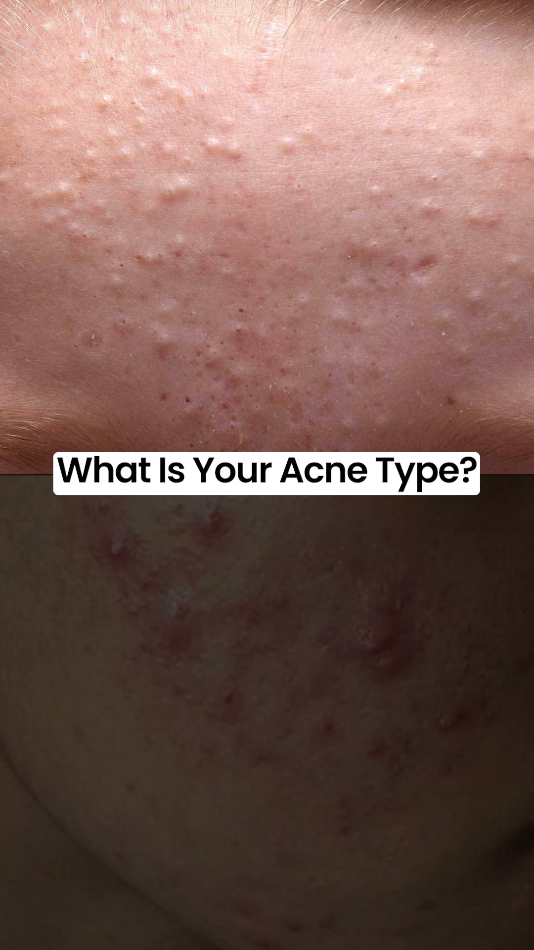 Clear.Ritual Facebook ad: Take the FREE Skin Test