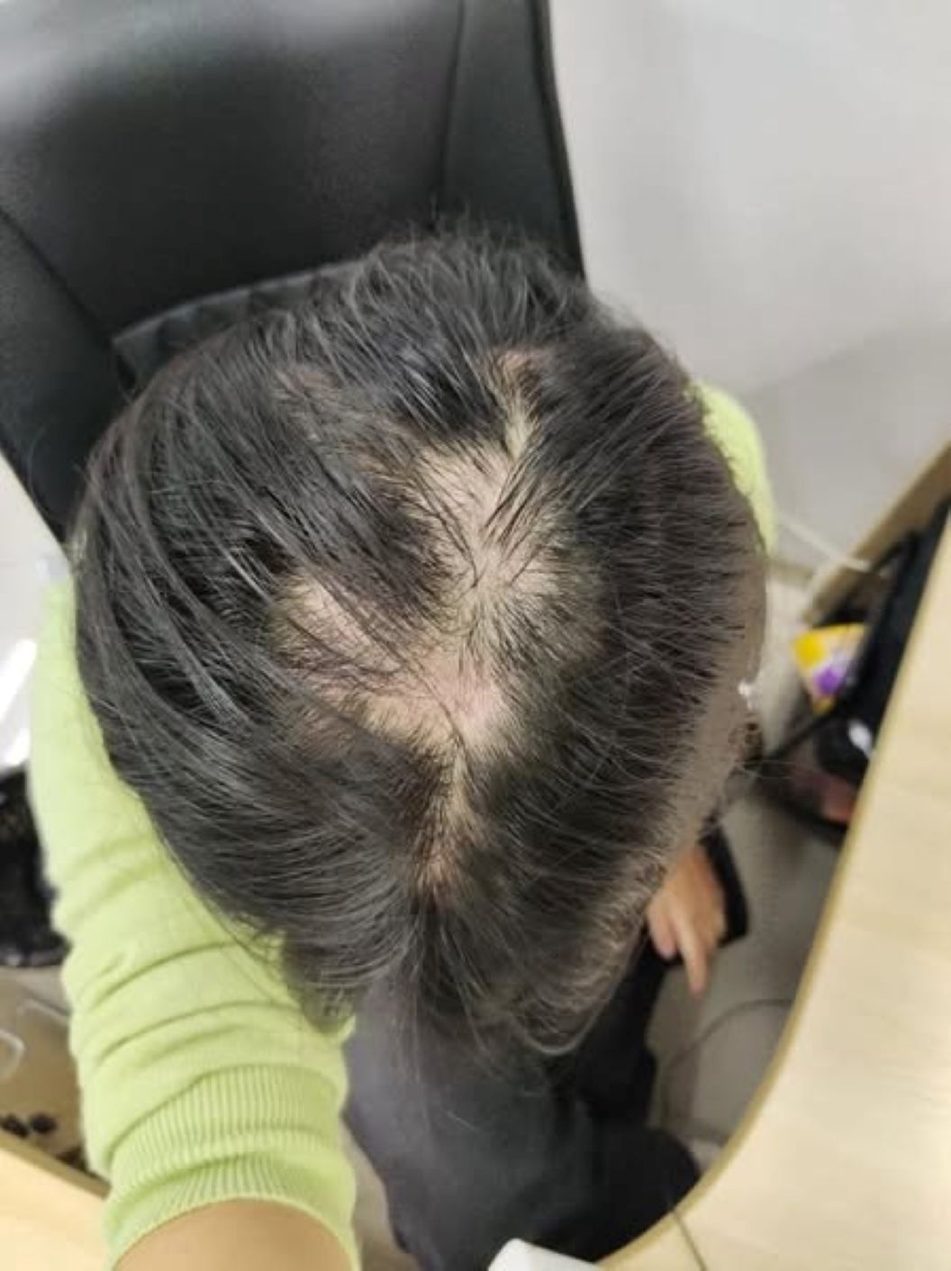 Rosa Aesthetic - Makati's No. 1 Intensive Hair Treatment Facebook ad: [BN8173 - THIN HAIR TREATMENT]