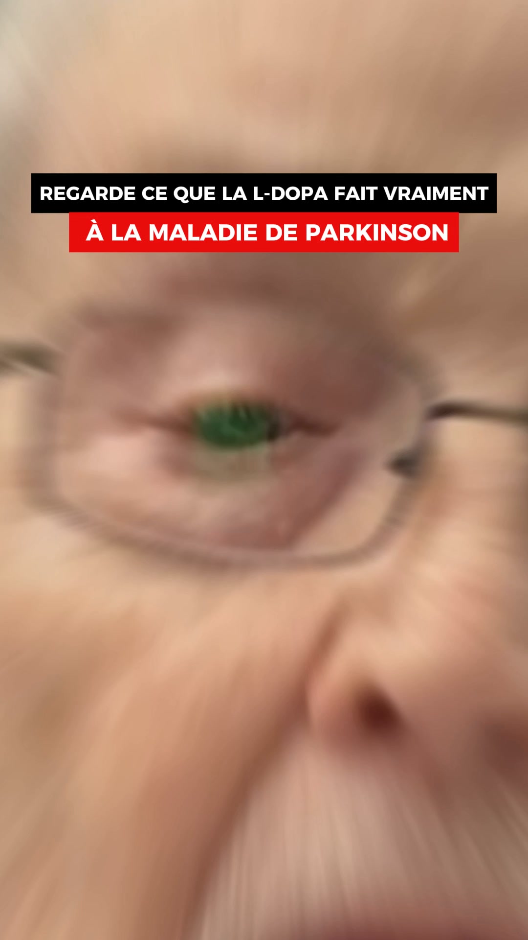 Parkinson Info Santé Facebook ad: Le Problème Que Ton Traitement Ne Touche Pas