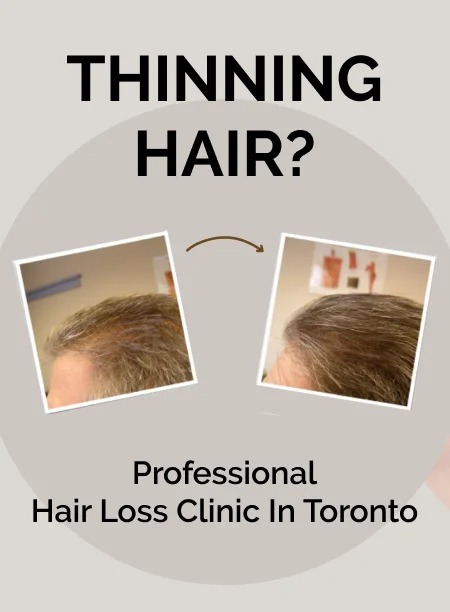Antech Hair & Skin Clinic Facebook ad