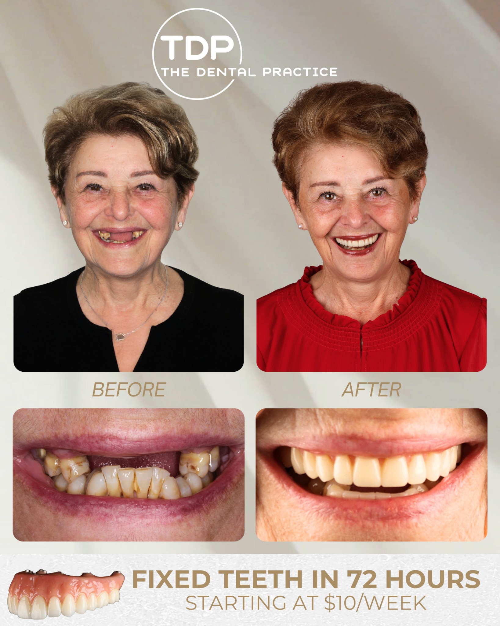 The Dental Practice and The Inner West Dental Implant Centre Facebook ad: Explore Implant Options & Flexible Payment Plans