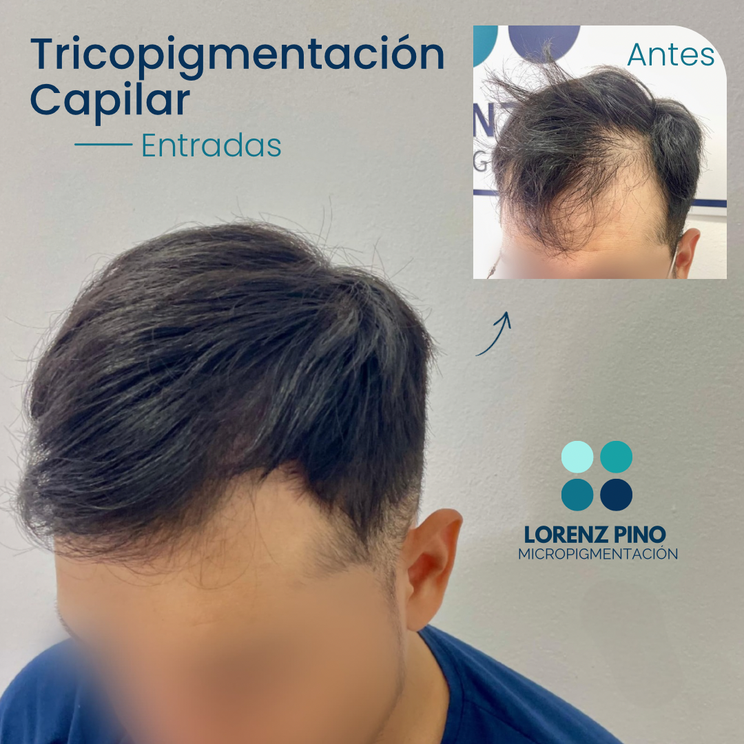 Lorenz Pino Facebook ad: ¿Entradas?