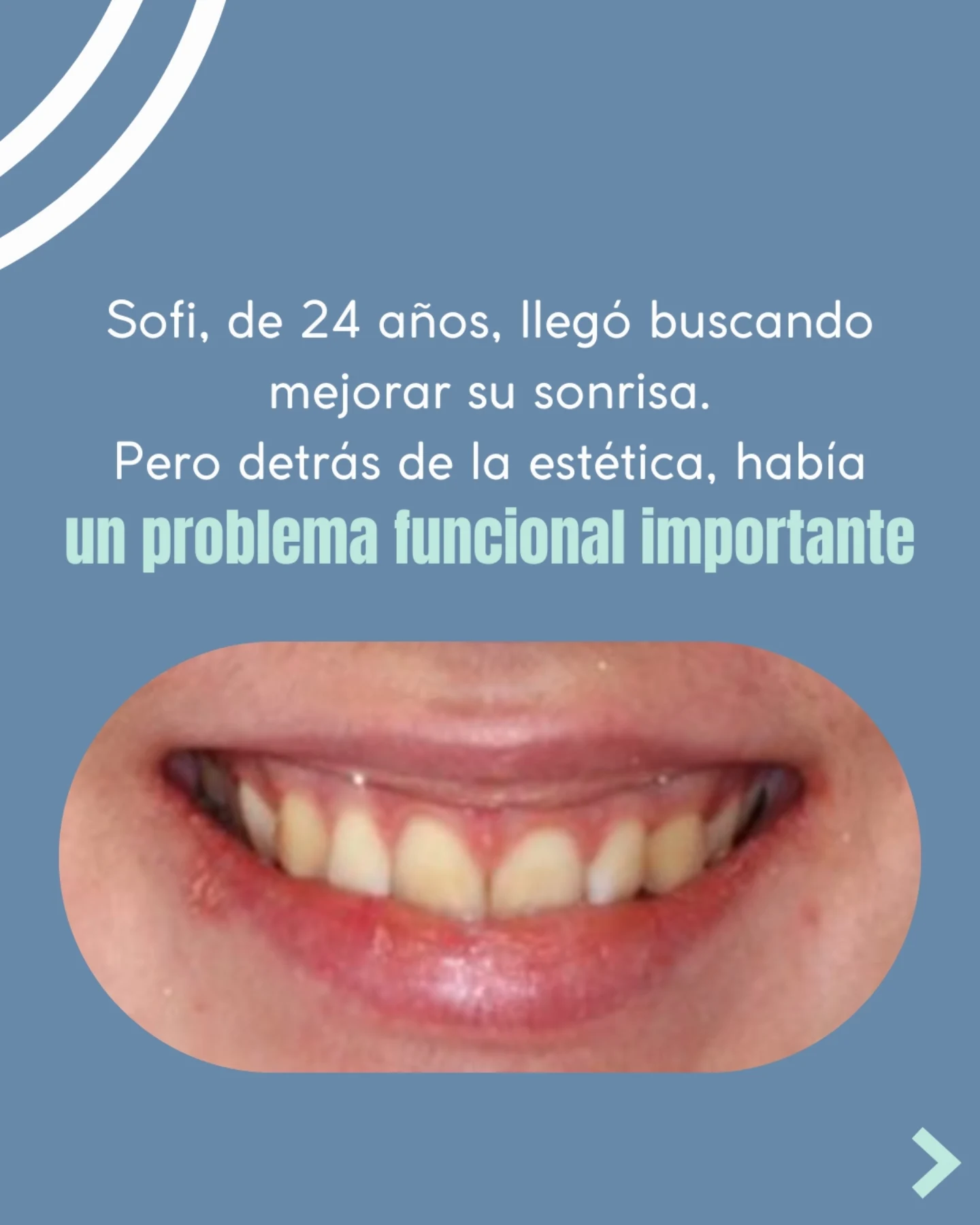 B&R Odontología Integral Facebook ad: La ortodoncia no siempre se trata solo de…