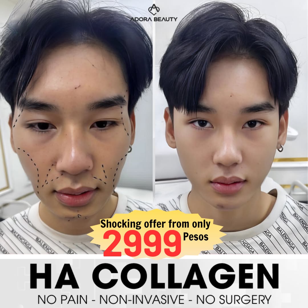 ADORA Beauty Center - Where beauty reigns Facebook ad