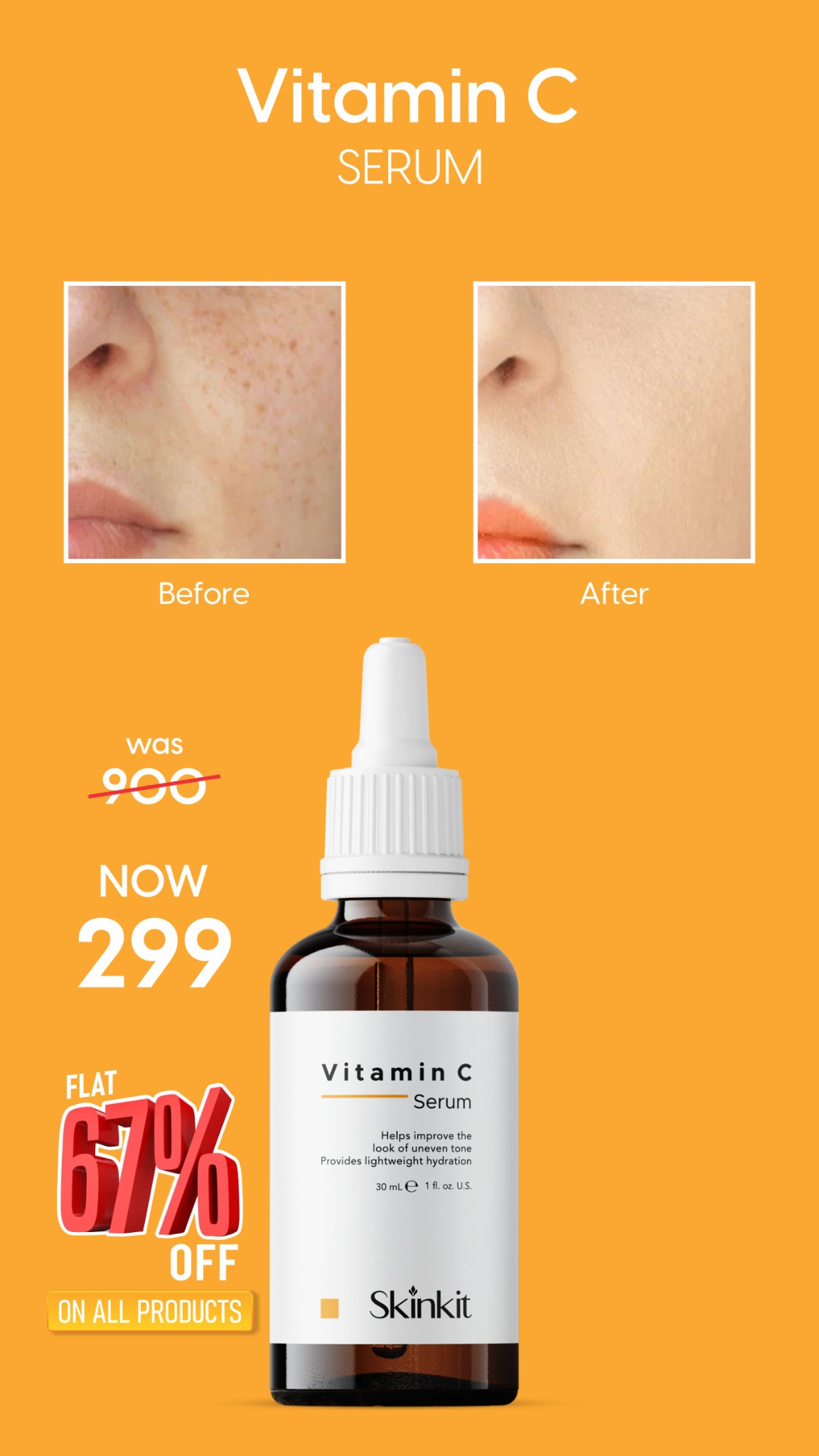 Skin Kit Facebook ad