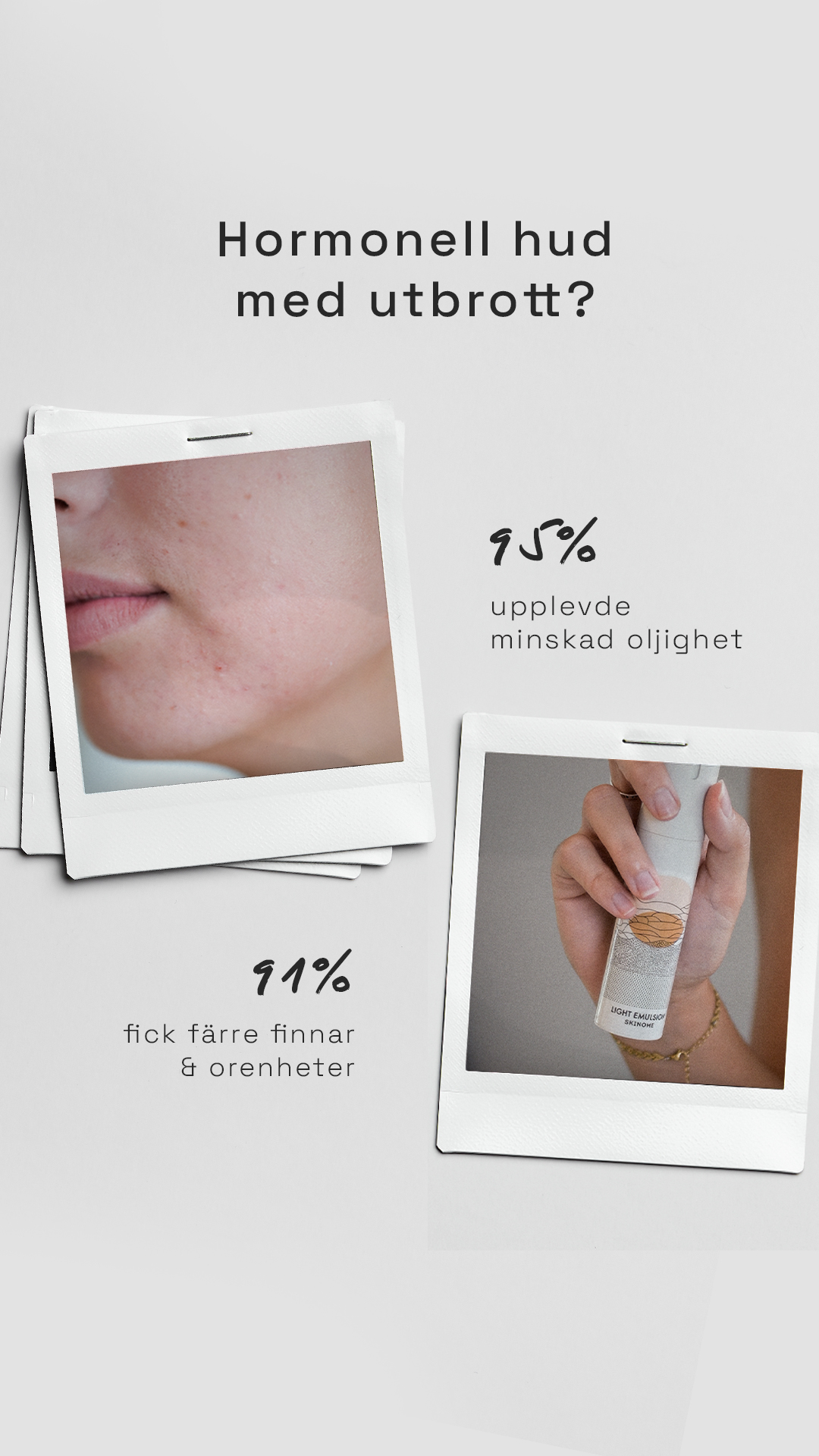 Skinome Facebook ad