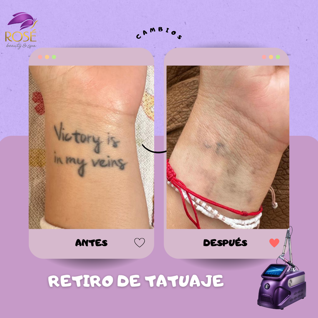 Rosé Beauty and Spa  Facebook ad