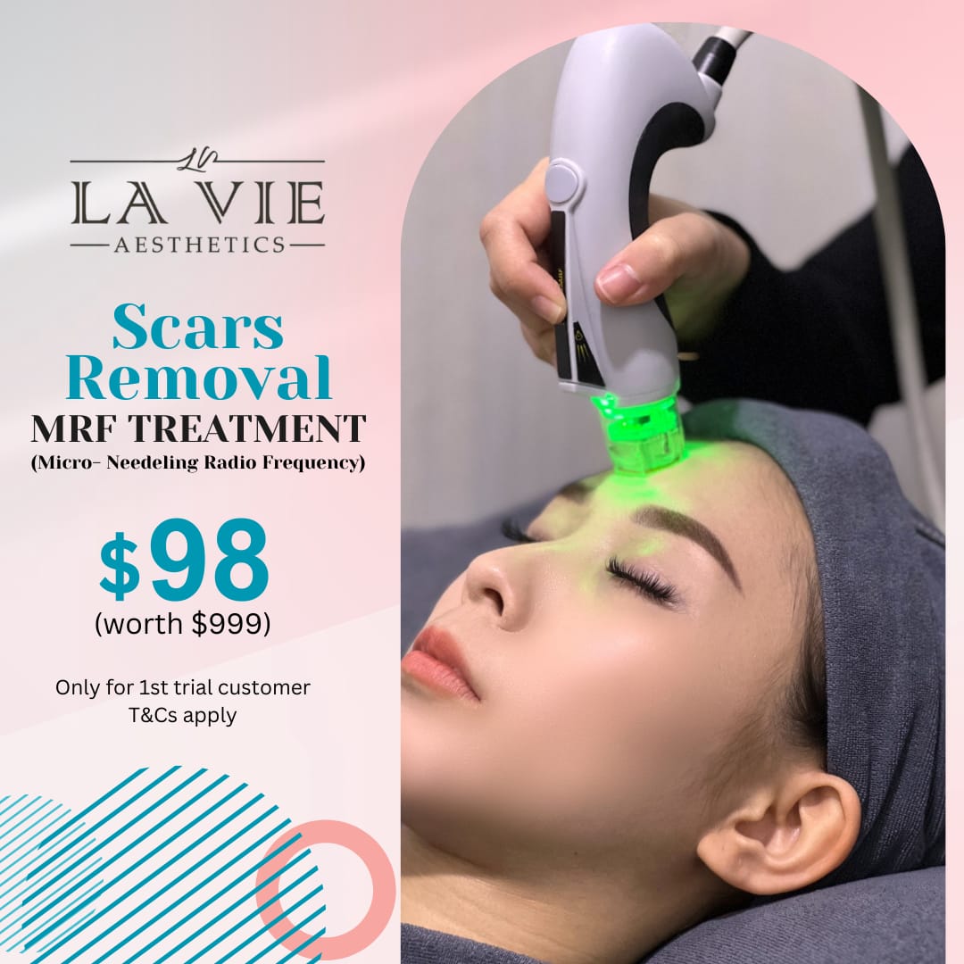 La Vie Aesthetics SG Facebook ad: Award Winning: Best Scar Removal Facial