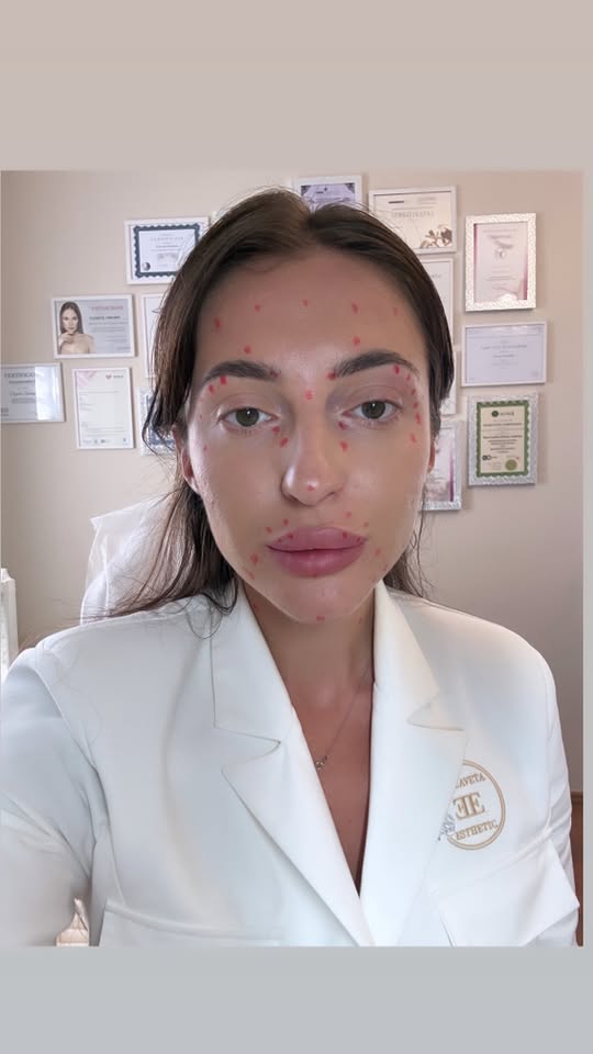 Elizaveta Esthetic Facebook ad: KODĖL FULL FACE BOTOX DUODA TOKIUS GERUS REZULTATUS?