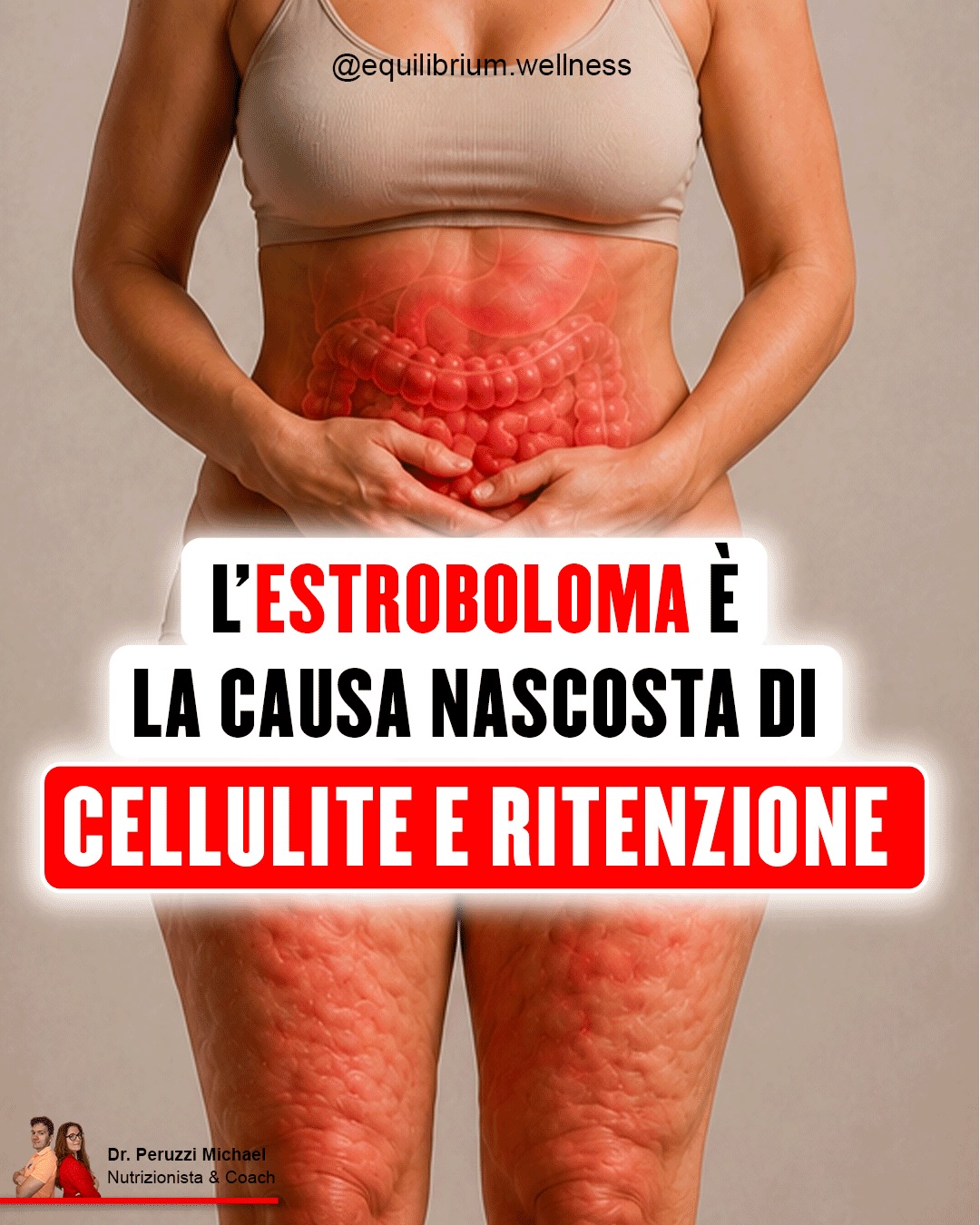 Dott. Michael Peruzzi Facebook ad: Hai cellulite e ritenzione da anni.